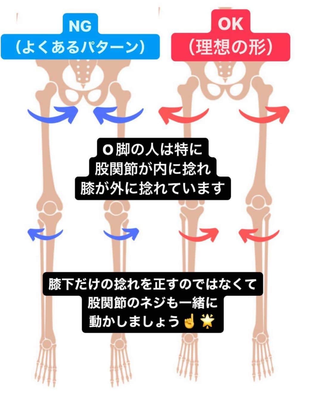 村田友美子さんのインスタグラム写真 - (村田友美子Instagram)「脚の形って変わるんですか？ 脚だけ細くできますか？ ってよく聞かれます。  こたえは やることやって 頑張れば変わる‼️  Ｏ脚で悩んでるひと、前ももパンパン、ふくらはぎが太い！とかも遺伝かと思いきや実は単なる歪みなんだよね。  一枚めの写真のかなこちゃんは 40年間ずーっとＯ脚に悩んでて ありとあらゆる整体、エステ、トレーニング、、、あやしさ全開なとこも多数経験したらしい。  でもユミコア始めてだんだん良くなって、今や真っ直ぐだし細いしお尻も超丸くて上にあるし完全にＯ脚のイメージゼロ‼️  骨って動くんだなぁって。伝わるかな？ 骨が動くと筋肉や脂肪のつき方も変わるから細くなったり見え方が変わる🫶🏻  筋トレしたら脚が細くなるって思っている人がよくいるけど、その前にやることがいっぱいある。  ⭐️足裏や足指をゆるめたりたくさん動かす ⭐️内側や外側に落ちている足首を整える ⭐️股関節まわりをゆるめる ⭐️股関節と骨盤をはめこむ ⭐️もろもろインナーのトレーニング(クラムやうちももトレなど) ⭐️歩きかた(重心の位置)を変える などなど  かなこちゃんからのメッセージ 脚を治すにはとにかく脚だけやれば良いと思ってたけど実は呼吸とコアがすごく大事なことに気づいたってラインくれた。  Ｏ脚や脚の太さ、下半身で悩んでる人はあきらめないで やろう‼️‼️‼️  一番最後の動画、私よくやるやつ❤️  #Ｏ脚改善 #骨の向きを変える #筋トレではない #脚は細くなる #ただ歪みがあるだけ #とりあえずやろ @onlineyumicore  @yumicorebodyofficial」10月13日 23時49分 - yumicorebody