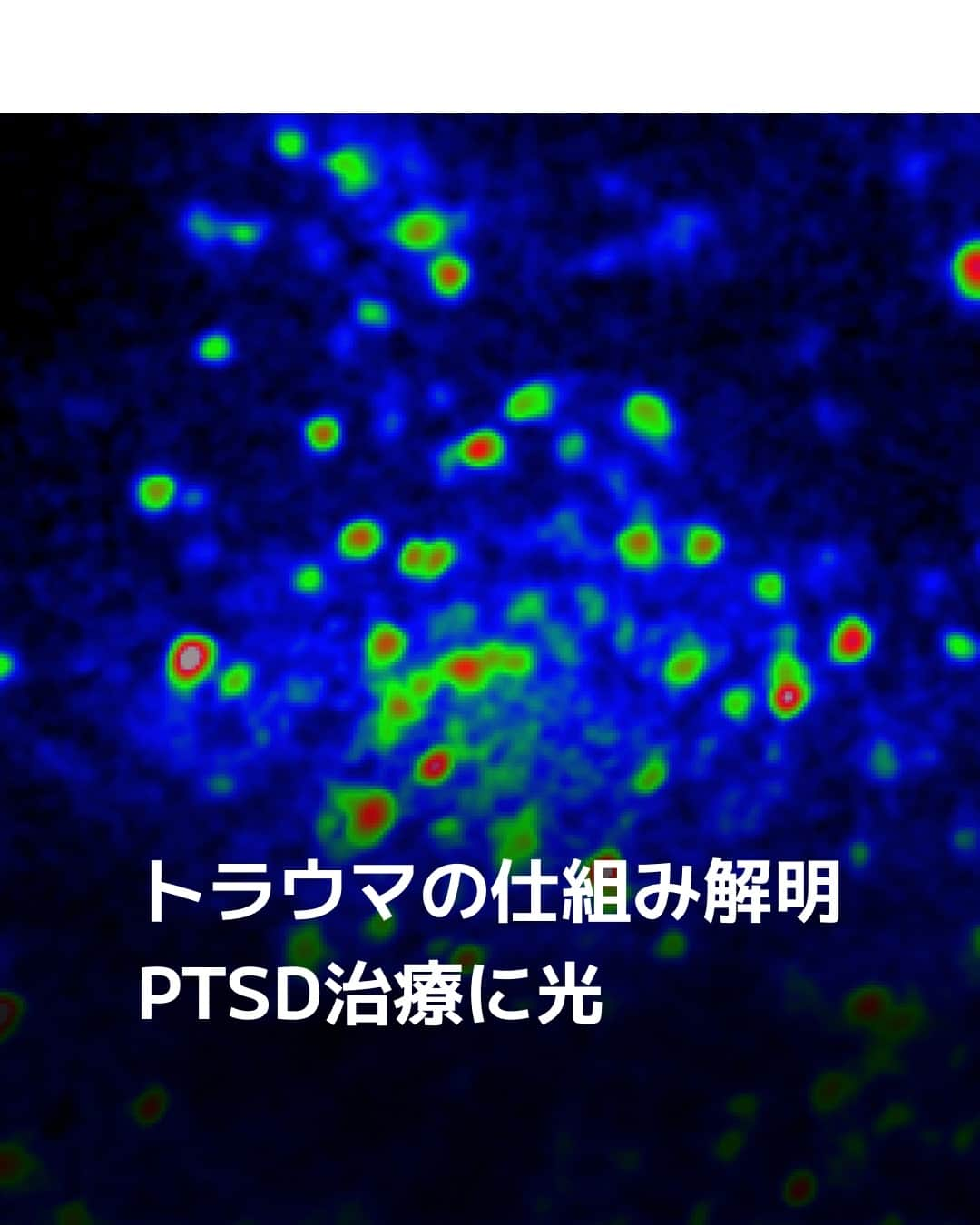 日本経済新聞社さんのインスタグラム写真 - (日本経済新聞社Instagram)「トラウマの仕組み解明、PTSD治療に　生理学研究所の研究者は「恐怖体験によって強く反応する細胞がハブになっている。この細胞を働かなくすれば恐怖の記憶を思い出させなくできるかもしれない」とみています。⁠ ⁠ 詳細はプロフィールの linkin.bio/nikkei をタップ。⁠ 投稿一覧からコンテンツをご覧になれます。⁠→⁠@nikkei⁠ ⁠ #日経電子版 #トラウマ ＃PTSD」10月14日 12時00分 - nikkei