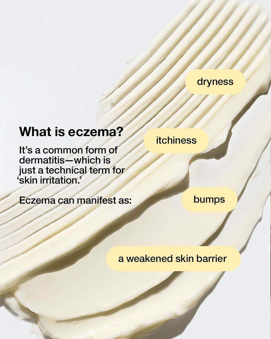 クリニークさんのインスタグラム写真 - (クリニークInstagram)「Skin School: Everything you ever wanted to know about eczema (but were afraid to ask.)   #Clinique #SkinSchool #Eczema #EczemaAwarenessMonth #DermatologistTested」10月16日 22時54分 - clinique