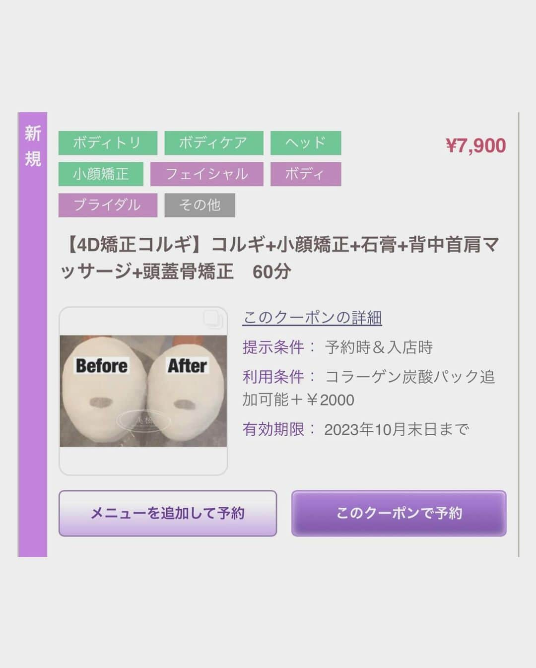 Yukariさんのインスタグラム写真 - (YukariInstagram)「🤍 🤍 🤍 こんばんはかようびっ🐰☪️ めちゃくちゃねむいけど耐えた👐🏽 がんばれわたし負けるなわたし👀🔥 . この間銀座にある小顔サロン…！ 『美極(びきょく)』さんに小顔コルギが 気になって行ってきたよ〰️👶🏼💡✨ ▶︎▶︎ @bikyoku_ginza )) . 私が受けたメニューはこちら！ ▫️小顔コルギ ▫️小顔矯正 ▫️石膏パック ▫️背中首肩デコルテマッサージ ▫️頭蓋骨矯正 豪華な60分です💆🏽‍♀️💎 . コルギって初めてだったんだけど 痛気持ちよくてすんごいスッキリした🥹❕ 顔が整って小さくなるなら痛みも ヨユーで耐えられちゃう🙋🏽‍♀️◎笑 . 顔の歪みが気になってたんだけど しっかりと調節してもらってさらには 背中や肩、首周り、デコルテの マッサージも最高すぎて寝そうでした🥱❣️ . 写真も載せたんだけど石膏パックも ひんやりからのじんわり温かくて リラックスしながら終えた😌💤 . 固まった石膏パックを終わった後に 顔にはめたら全然サイズ変わってて ビックリ🫢‼️コルギパワー恐るべし💥🫶🏽 . . PR @bikyoku_ginza  . . #美極totalbeauty銀座店  #銀座エステサロン  #銀座エステ  #完全個室サロン  #小顔コルギ  #小顔エステ  #東京エステ  #銀座小顔 #銀座  #小顔サロン  #小顔矯正  #コルギ  #コルギマッサージ  #韓国コルギ  #小顔になりたい  #小顔になる方法  #かわいくなりたい  #可愛くなりたい  #女子力向上委員会  #女子力アップ  #自分磨き  #自分にご褒美  #ギャル  #ぎゃる  #ギャルメイク」10月17日 20時32分 - xxsonchanxx