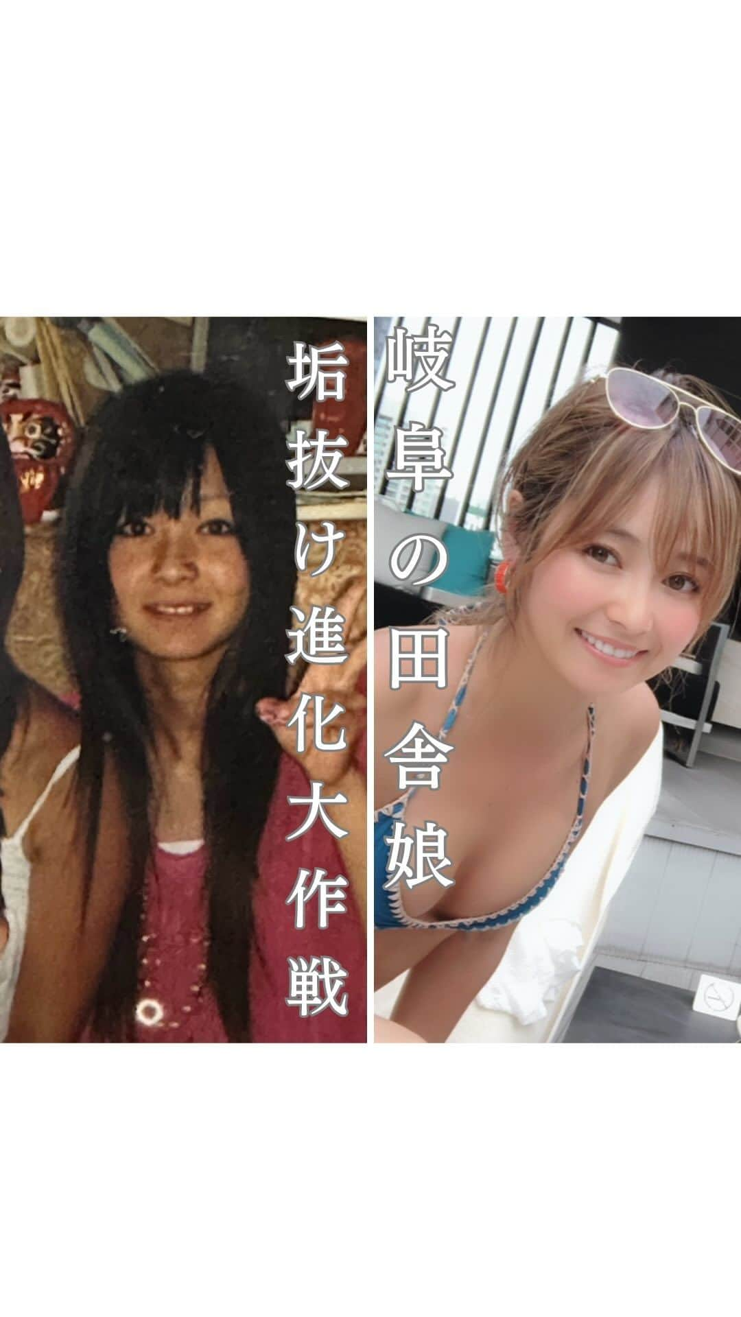 山口夏実のインスタグラム：「【岐阜の田舎娘による垢抜け進化大作戦！】  山と川しかない田舎で育った私。 18歳まで部活に明け暮れた毎日で、外見を気にするとしたら 眉毛しか気にしたことなかったです😌(めちゃくちゃ細い)  卒業して美容学校に入り、ちょこっと美意識が上がったのですが ギャルになる一方🥹   歯のことは「あれ、一本奥に入ってる？一本なくない？」と 思ってるだけで治す概念がありませんでした😳  でも治したらびっくり！ ほうれい線まで薄くなったような..😳🤍  歯が広がって顔にフィットしたのか、かなり薄くなりました🥹(まだある) ホワイトニングとクリーニングを毎月しているおかげで 歯はピカピカ。 鶴田先生には感謝です🥺🤲  そんなプルチーノ歯科では現在家族割キャンペーン開催中！ 歯が気になるみなさん、ぜひ行ってみてくださいね♡ (東京、三重、愛知にあります)   @pulcino.dental  @pulcino_do_yokkaichi  @pulcino_do_tokyo  @pulcino_dental_office  @pulcino_do_jingumae  <<<<<<<<<<<<<<<<<<<<<<<<<<<<<< MAKE&HAIR @natsumi19910625 private🍋　@natsu_koryouri workout 🌿 @natsumi_workout  <<<<<<<<<<<<<<<<<<<<<<<<<<<<<<  #メイク#新作コスメ#コスメレビュー#美容垢#新作コスメ#メイク動画#コスメ好きさんと繋がりたい#make#cosme#makeup#秋コスメ#秋メイク#イエベ春#カラコンなし#秋新作コスメ2023#歯並び#垢抜け#垢抜け物語#インビザライン#ワイヤー矯正#ホワイトニング#歯#歯磨き#名古屋歯医者#東京歯医者#三重歯医者」