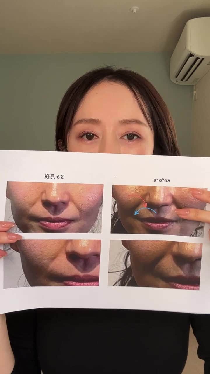 エリーのインスタグラム：「何故老け見えするのか？について 解説しながらポスポスしてました👩🏻‍🏫  自分の課題を見つけて コツコツと向き合えるさかなで 居たいですよね🐟  @corefit_bbyc 公式サイトで 1万円以上のお買い物で使える 1000円オフクーポン→er22 10/31 23:59まで使えます。  48時間限定で Dproグリップお買い求めの方には よりほぐして上がる手助けをしてくれる ディープフィッターという美容液一本 プレゼントになります❤️」