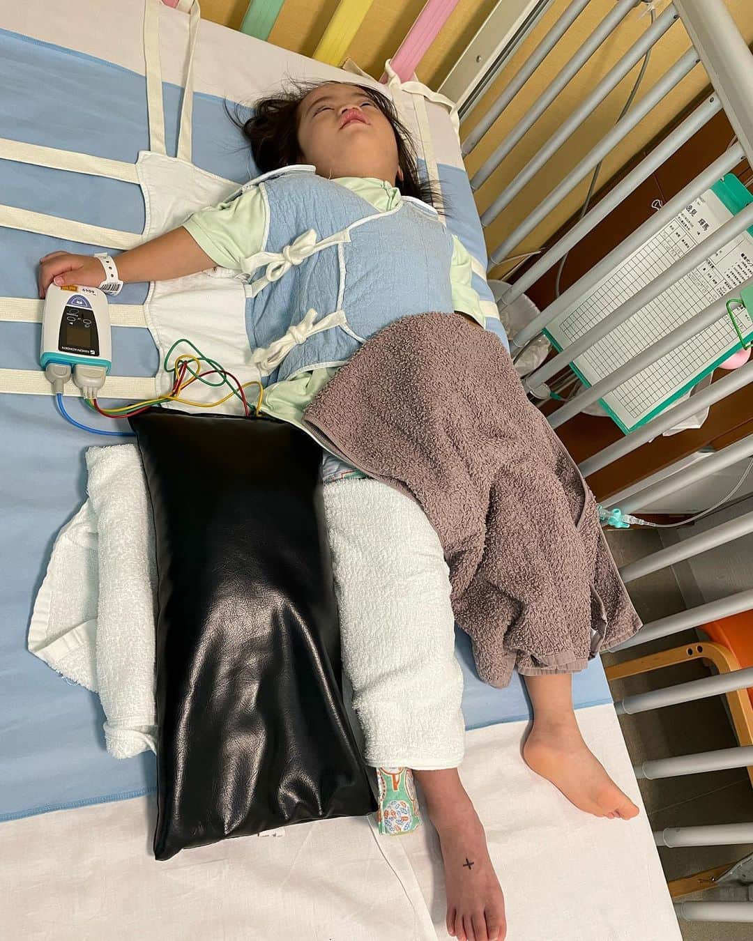 桜田聖子さんのインスタグラム写真 - (桜田聖子Instagram)「今日は、無事にカテーテル検査を行うことが出来ました😊  朝、手術着に着替えてから、何かを察したのか、いつもより元気がなく、ずっとベッドで寝っ転がったり、私のお膝に甘えてきたり。  看護師さんに抱っこされて検査に向かう時は、少しだけ行くのを嫌がる素振りを見せながらも、小さくバイバイをして、入って行きました。  全身麻酔が効いた状態で戻ってからは、しばらく寝ていたけど、さっき機嫌良く起きて、水分を摂ることも出来たので、ホッと一安心です😮‍💨 　 ももの付け根の太い血管からカテーテルを入れて、心臓や肺の検査を行った為、傷口が開かない様に、身体と右足を完全固定。  動けないと、そのうち怒るだろうなぁ〜😅  ひとまず、順調です👍🏻  8枚目の写真、約2年前の今頃。ゆっくりながらも、随分と大きくなったもんだ❣️  #downsyndrome #specialneeds #trisomy21 #ダウン症 #ダウン症候群 #トリソミー21 #4歳8ヶ月 #成長記録 #生まれてきてくれてありがとう  #心室中隔欠損症  #男の子ママ  #男の子 #boy #ダウン症ボーイ #trisomy21boy #カテーテル検査」10月25日 15時21分 - seikosakurada