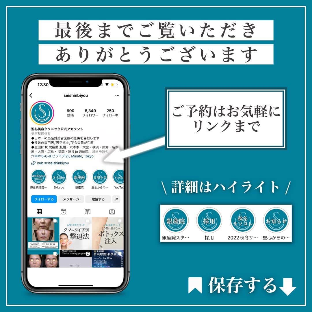 聖心美容クリニック公式アカウント さんのインスタグラム写真 - (聖心美容クリニック公式アカウント Instagram)「. ＼【30代女性・人中をできるだけ短くしたい！！】 プレミアムリップリフト（プレミアム人中短縮術）＋プレミアム口角挙上術（術後1.5ヶ月）✨／  30代女性の患者様です。 “人中をできるだけ短くしたい！！口元のバランスを整えたい！！” とのご希望あり、「プレミアムリップリフト（プレミアム人中短縮術）」＋「プレミアム口角挙上術」の複合手術を行いました。  なお、「プレミアムリップリフト（プレミアム人中短縮術）」は、いわゆる“筋肉処理”等を追加した術式です。  Afterは１ヶ月半後になります。 “口角挙上術”も併せて行ったことで、口元のバランスが“より”整いました。  症例紹介アカウント（ @seishin_beforeafter ）で他の症例もチェックしてみてくださいね💕  一人ひとりのご希望に寄り添う丁寧なカウンセリング🏥 あなたの悩みに最適なオンリーワンの施術を🌷 聖心美容クリニックの無料カウンセリングは下記からお気軽にご連絡ください✨  ･+････+････+････+･･ 📲WEB予約：プロフィールからリンクをクリック　@seishinbiyou 📞電話予約：0120-112-614 🍀LINE予約：「聖心美容クリニック」で検索 ･+････+････+････+･･  --------------------------- 👨‍⚕️担当医 六本木院 大宮院 名古屋院医師  菱田 健作 ( @seishin_hishida )  💉施術名 プレミアムリップリフト + プレミアム口角挙上術  🌱施術内容  ◎プレミアムリップリフト  カウンセリング時、白唇部の短縮量を設定。短縮量を基準に鼻孔底と白唇（唇と鼻の間）の境界線上に、W型の予定切除部位をデザインし、局所麻酔を行ない余剰な組織を切除した後、十分に止血し創閉鎖。  ◎プレミアム口角挙上術  デザインに沿って皮膚切除。場合によって眼輪筋切除や、皮下剥離などの処理を行なう。非吸収糸で形態を調節しながら皮下、皮膚を縫合する。  ⚠️リスク・副作用  ◎プレミアムリップリフト  術後の浮腫、皮下出血、感染、創離解。傷跡、肥厚性瘢痕、色素沈着。前歯の露出。鼻柱の下降。  ◎プレミアム口角挙上術  腫れ、内出血、感染、肥厚性瘢痕、左右差  💰費用 803,000円（税込） ---------------------------  #スマイルリップ #リップリフト #鼻整形 #人中短縮 #鼻下短縮術 #口角挙上術  #美容クリニック  #美容整形  #美容医療  #美容皮膚科  #とことん真面目に美容医療  #聖心美容クリニック #聖心美容クリニック大宮院 #聖心美容クリニック六本木院 #聖心美容クリニック名古屋院」11月19日 18時36分 - seishinbiyou