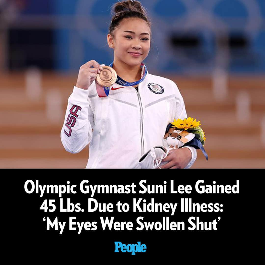 People Magazineのインスタグラム：「Suni Lee is looking back on a “scary” health complication that she recently faced. Earlier this year, the 20-year-old world champion gymnast said she’d been diagnosed with an incurable kidney disease. On Thursday, she explained just how concerning things had gotten, noting that she gained 45 pounds this year due to the illness.  More on this in our bio link. | 📷: Getty」