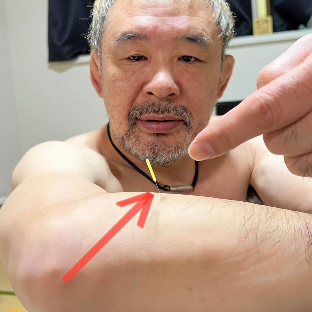 saku39shopのインスタグラム：「. 【receive acupuncture】 . 季節の変わり目になると古傷が痛みます。 鍼を打ってもらいました。 身体のメンテナンスは大事ですね。 . #桜庭和志 #鍼灸」