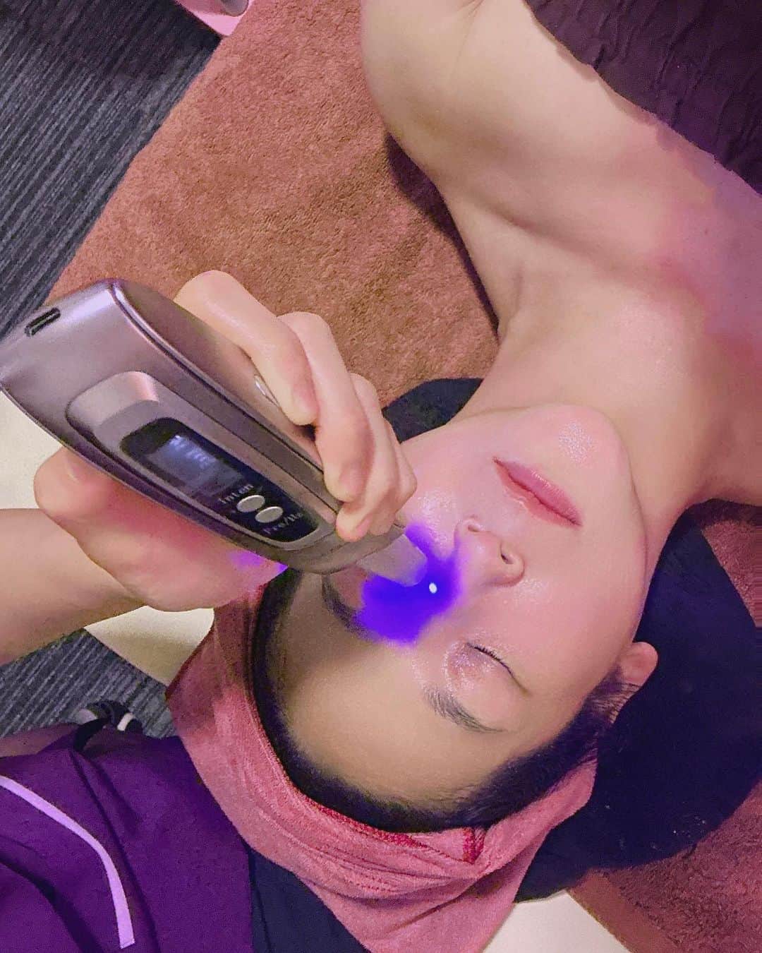 世手子さんのインスタグラム写真 - (世手子Instagram)「PR  Facial beauty treatment using COLD PLASMA, a popular beauty device in Korea🇰🇷 No downtime🤩 Effective for acne scars, scars, pores, age spots, and sagging skin👏 @plasma_kanby1  #韓美 #韓国美容 #韓国コルギ #川崎エステ #川崎サロン #川崎フェイシャル #川崎コルギ #プラズマフェイシャル 行ってきたよ^_^ 韓国で流行中の美容機器COLD PLASMAを使ったフェイシャルエステ(ﾟ∀ﾟ) ダウンタイムなしだからいいね(*☻-☻*) まずはコルギして プラズマ施術したよ ニキビ跡、傷跡、毛穴、シミ、たるみに効果ありです（＾ν＾） ピリピリする感じ 施術後に鎮静パックで終わり(*^◯^*) 日本にいながら韓国のプラズマ施術できるのは嬉しい(*'ω'*) 是非やってみて(￣∀￣)」11月21日 8時43分 - rojide