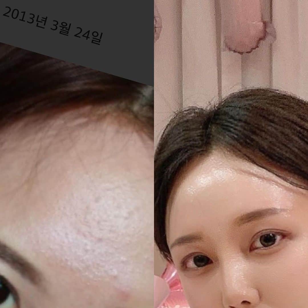 キム・ウンジュさんのインスタグラム写真 - (キム・ウンジュInstagram)「#올해마지막공구 겨울철만 되면 피부가 쩍쩍 갈라져서 모공과 주름사이에 피부 화장이 껴서 피부 화장이 고민이신분들🖐🏻  랑느 시그니처인 골드라인은 겨울철 히터바람에도 끄덕없이 속광부터 광이 은은하게 차올라서 피부가 예뻐보이는건 물론 ! 모든 피부 타입이 사용 할 수 있을 뿐더러 전자극 테스트 완려된 제품입니다  클린징겔부터 크림까지 각 각 효능은 다르지만 써보시면 정말 후회없을정도로 만족하실 거예요✨  ✨필링젤✨ 5대 각질케어 성분들이 피부의 묵은 각질들을 자극적이지 않게 제거하여 피부톤을 한층 더 밝고 맑게 정돈하여 매끄러운 피부를 만드는데 도움을 줍니다  ✨클렌징겔✨ 세안,보습,진정까지 케어해주는 클렌징겔 정말 순하면서 피부 장벽까지 지켜주며  세안 후 피부 땅김이 없어요 꾸준히 사용하시다보면 유수분 밸런스를  잘 맞춰져 피부 속 부터 좋아지시는게 느껴지실 거예요  비타민 A.D.E.F 함유로 강력한 항산화 및 보습 효과  ✨토너✨ 토너는 메이크업 제품을 바르기전 피부결을 정돈해  다음 제품의 흡수율을 높여주는 부스팅 역활을 해줍니다 보습,진정,생기부여,탄력케어가 가능한 올인원제품  ✨앰플✨ 보습 , 진정 , 미백 , 탄력강화 30가지의 프리미엄 원료를 최적의 배합으로 만들어낸 데일리 스파 올인원 제품 민감성 , 복합성 , 지성 , 건성  모든 피부 타입에 사용 가능   ✨크림✨ 피부 저자극 테스트 완료 11겹의 히알루론산이 피부에 촘촘하게 스며드는 보습크림  우리나라 5성급 호텔 및 유명 스파에 실제로  납품 되고 있는 제품인만큼 사용해보시면 정말 만족하실 거예요😎 아직 랑느 입문자라면 어떤걸 구매할지 고민되실때 디엠주시면 상담도와드릴게요❤️‍🔥」11月21日 19時16分 - eun_ju__