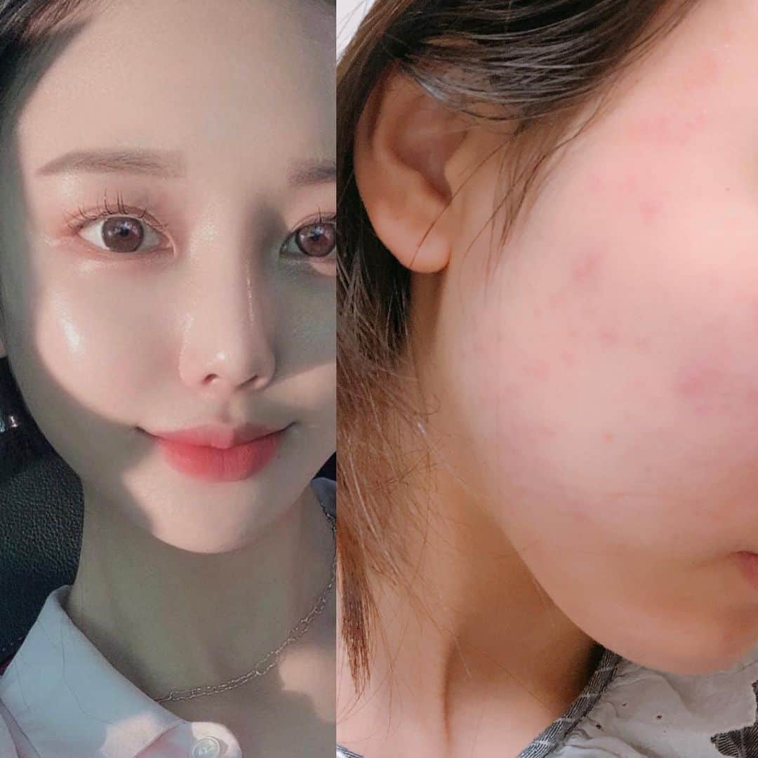 キム・ウンジュさんのインスタグラム写真 - (キム・ウンジュInstagram)「#올해마지막공구 겨울철만 되면 피부가 쩍쩍 갈라져서 모공과 주름사이에 피부 화장이 껴서 피부 화장이 고민이신분들🖐🏻  랑느 시그니처인 골드라인은 겨울철 히터바람에도 끄덕없이 속광부터 광이 은은하게 차올라서 피부가 예뻐보이는건 물론 ! 모든 피부 타입이 사용 할 수 있을 뿐더러 전자극 테스트 완려된 제품입니다  클린징겔부터 크림까지 각 각 효능은 다르지만 써보시면 정말 후회없을정도로 만족하실 거예요✨  ✨필링젤✨ 5대 각질케어 성분들이 피부의 묵은 각질들을 자극적이지 않게 제거하여 피부톤을 한층 더 밝고 맑게 정돈하여 매끄러운 피부를 만드는데 도움을 줍니다  ✨클렌징겔✨ 세안,보습,진정까지 케어해주는 클렌징겔 정말 순하면서 피부 장벽까지 지켜주며  세안 후 피부 땅김이 없어요 꾸준히 사용하시다보면 유수분 밸런스를  잘 맞춰져 피부 속 부터 좋아지시는게 느껴지실 거예요  비타민 A.D.E.F 함유로 강력한 항산화 및 보습 효과  ✨토너✨ 토너는 메이크업 제품을 바르기전 피부결을 정돈해  다음 제품의 흡수율을 높여주는 부스팅 역활을 해줍니다 보습,진정,생기부여,탄력케어가 가능한 올인원제품  ✨앰플✨ 보습 , 진정 , 미백 , 탄력강화 30가지의 프리미엄 원료를 최적의 배합으로 만들어낸 데일리 스파 올인원 제품 민감성 , 복합성 , 지성 , 건성  모든 피부 타입에 사용 가능   ✨크림✨ 피부 저자극 테스트 완료 11겹의 히알루론산이 피부에 촘촘하게 스며드는 보습크림  우리나라 5성급 호텔 및 유명 스파에 실제로  납품 되고 있는 제품인만큼 사용해보시면 정말 만족하실 거예요😎 아직 랑느 입문자라면 어떤걸 구매할지 고민되실때 디엠주시면 상담도와드릴게요❤️‍🔥」11月21日 19時16分 - eun_ju__