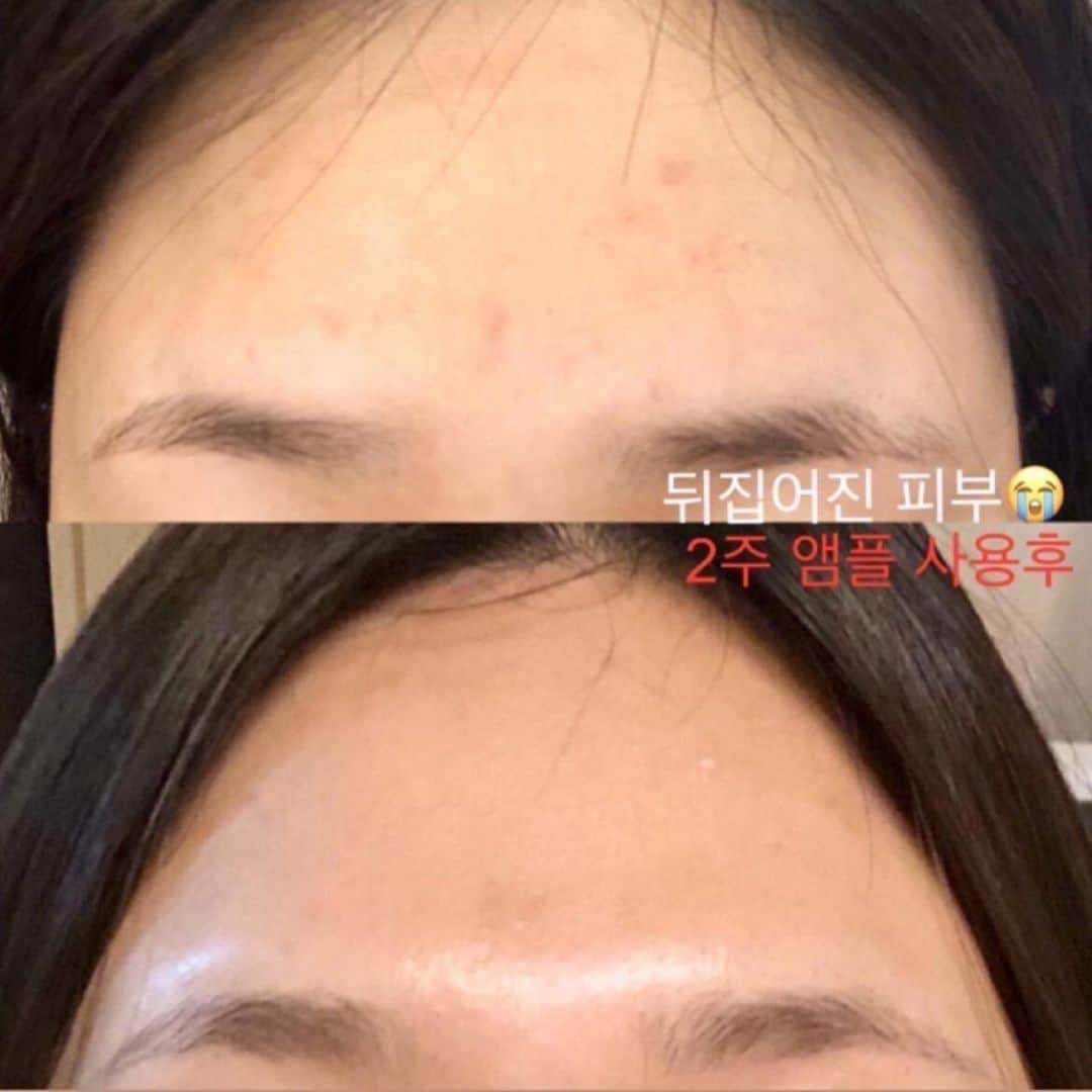 キム・ウンジュさんのインスタグラム写真 - (キム・ウンジュInstagram)「#올해마지막공구 겨울철만 되면 피부가 쩍쩍 갈라져서 모공과 주름사이에 피부 화장이 껴서 피부 화장이 고민이신분들🖐🏻  랑느 시그니처인 골드라인은 겨울철 히터바람에도 끄덕없이 속광부터 광이 은은하게 차올라서 피부가 예뻐보이는건 물론 ! 모든 피부 타입이 사용 할 수 있을 뿐더러 전자극 테스트 완려된 제품입니다  클린징겔부터 크림까지 각 각 효능은 다르지만 써보시면 정말 후회없을정도로 만족하실 거예요✨  ✨필링젤✨ 5대 각질케어 성분들이 피부의 묵은 각질들을 자극적이지 않게 제거하여 피부톤을 한층 더 밝고 맑게 정돈하여 매끄러운 피부를 만드는데 도움을 줍니다  ✨클렌징겔✨ 세안,보습,진정까지 케어해주는 클렌징겔 정말 순하면서 피부 장벽까지 지켜주며  세안 후 피부 땅김이 없어요 꾸준히 사용하시다보면 유수분 밸런스를  잘 맞춰져 피부 속 부터 좋아지시는게 느껴지실 거예요  비타민 A.D.E.F 함유로 강력한 항산화 및 보습 효과  ✨토너✨ 토너는 메이크업 제품을 바르기전 피부결을 정돈해  다음 제품의 흡수율을 높여주는 부스팅 역활을 해줍니다 보습,진정,생기부여,탄력케어가 가능한 올인원제품  ✨앰플✨ 보습 , 진정 , 미백 , 탄력강화 30가지의 프리미엄 원료를 최적의 배합으로 만들어낸 데일리 스파 올인원 제품 민감성 , 복합성 , 지성 , 건성  모든 피부 타입에 사용 가능   ✨크림✨ 피부 저자극 테스트 완료 11겹의 히알루론산이 피부에 촘촘하게 스며드는 보습크림  우리나라 5성급 호텔 및 유명 스파에 실제로  납품 되고 있는 제품인만큼 사용해보시면 정말 만족하실 거예요😎 아직 랑느 입문자라면 어떤걸 구매할지 고민되실때 디엠주시면 상담도와드릴게요❤️‍🔥」11月21日 19時16分 - eun_ju__