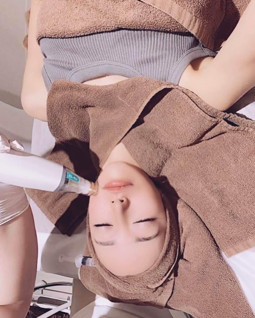 坂本礼美さんのインスタグラム写真 - (坂本礼美Instagram)「. . ゆんちゃん 🩷 @yunkoro519 🩷 のクリニック👩🏼‍⚕️ 🩶 @renataclinic 🩶にて✨  「Skin52」と「ポテンツァ」の施術を受けてきました👩🏼🤍🤍  「Skin52」とは、美容医療の先進国と言われる韓国から導入された、新しい「医療アートメイク」として注目されている技術🥸✨✨！ 色素を注入し周りの肌との色味を馴染ませることで、ストレッチマーク(肉割れ・妊娠線）や傷跡、白斑などを目立たなくすることができるんだって🫢🩶🩶🩶！  私はお尻の肉割れと🫣🍑腕にあった傷跡に施術してもらったよ👩🏼‍⚕️🤍！  看護師の中森先生🩷 @nakamori_skin_art 🩷がとーーっても丁寧にカウンセリングをしてくださり、麻酔クリームなしの施術だったんだけど、その理由や痛みの程度などもしっかりとわかりやすく説明してくださったので、めちゃくちゃ安心して受けられました🥹🙏🏻✨✨✨ 実際に、麻酔なしでも(個人差はあると思うけど、、)私は本当に本当に全く！痛くありませんでした🫢🫶🏻！ ジーーってなぞられてる感じだけだったよ🤣 アフターケアの仕方もしっかりと教えていただき🫡✨ 2回目の施術がもう今から楽しみです🫶🏻💭💭 何気にずっと気になっていた肉割れや傷跡がアートメイクで目立たなくなるのは本当に嬉しい🥺🙏🏻✨  「ポテンツァ」は顔の赤みや、毛穴、たるみなどが気になっていたので、この施術も看護師さんとしっかり相談して私に合った施術をしていただきました👩🏼‍⚕️🙇🏼‍♀️🩶🩶 もうすぐ34歳になるので🫣🤍 エイジングケアもしっかりやっていかないと🐰🩷🩷！ 麻酔クリームを塗ったので、痛みはほとんど感じず、終わったあとの肌の赤みもその日のうちに完全にひいてました🫢！  自分の為の美容dayをつくると気分もすごくはっぴーになるよね😇🤍🤍🤍  この日、ゆんちゃんと久しぶりに会えて👩🏼‍❤️‍👩🏼💕2人で1日美容dayだったので、終わってからは２人共すっぴんでご飯に行って🫶🏻🩷 すごくすごく幸せな1日でした☺️✨✨✨  中森先生👩🏼‍⚕️🩷ゆんちゃん🩷本当にありがとうございました🙇🏼‍♀️🩷🩷🩷！  🩶RENATA CLINIC🩶表参道院  📍 東京都港区南青山5丁目11-2 SANWA南青山ビル8階  表参道駅から徒歩3分でアクセスもいいし、クリニックに入るとめーーーっちゃくちゃいいにおいします💐💐💐☺️🤣🩷笑  #renataclinic #renataclinic表参道 #skin52 #ポテンツァ」11月1日 19時39分 - remi_1103