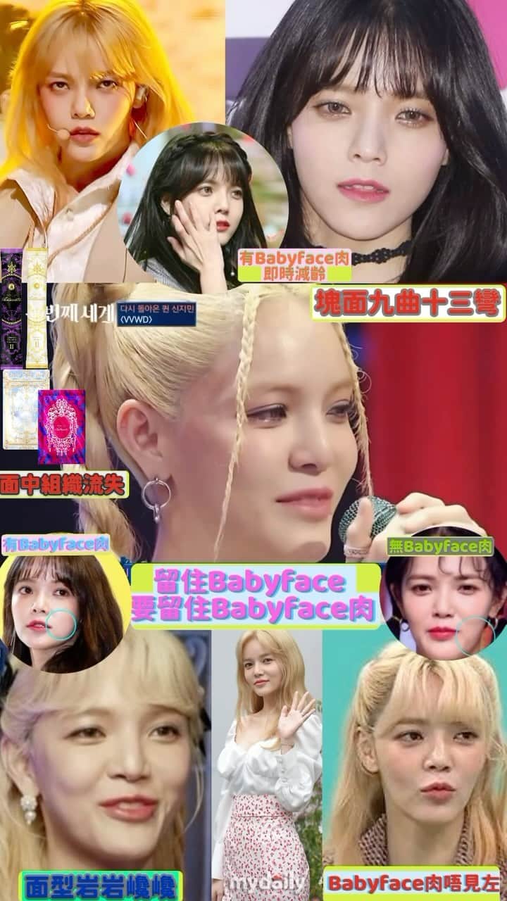 のインスタグラム：「留住babyface 要留住babyface肉 面中組織流失 面形變得岩岩巉巉 有Babyface肉 即時減齡 面部線條流暢  Babyface童顏丸提升Diamond填充能力 猶如注射填充效果～  #collagenpeptides #collagendrink #膠原蛋白 #膠原飲 #整形級 #修復肌膚 #整形 #美白 #微整形 #醫美 #醫美術後」