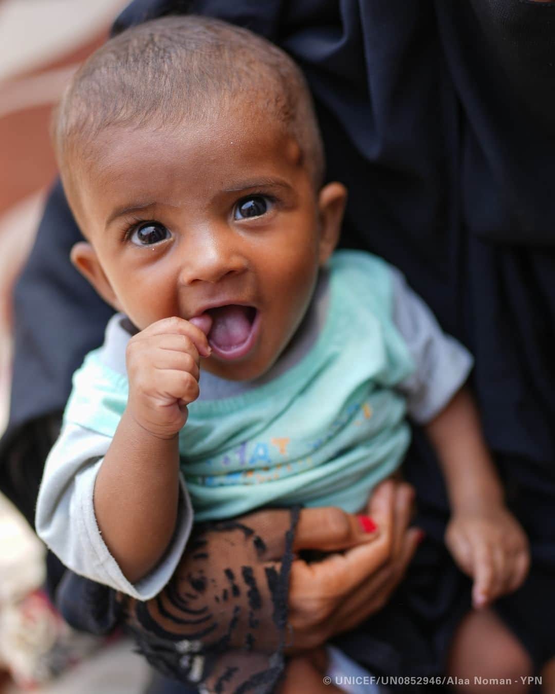 unicefさんのインスタグラム写真 - (unicefInstagram)「Baby Sanad was skeletal, screaming from hunger and getting sicker by the day in Yemen.   In desperation, his mother Raneem raced him to a UNICEF- and WHO-supported hospital where he was given therapeutic milk and medicine to jump-start his recovery.  At home, he ate ready-to-use therapeutic food, a paste packed full of calories, nutrients and vitamins, which helped him gain weight.   Thanks to the medical care Sanad has been receiving, he’s now significantly healthier. “I can’t believe he’s recovered so well,” says Raneem.  Sanad’s story is one that’s familiar to millions of children and their families globally. But with the right support, change is possible.    Ahead of a major Food Security Summit on 20 November, UNICEF is calling on leaders to urgently invest in the prevention, detection and treatment of severe malnutrition.」11月2日 3時00分 - unicef