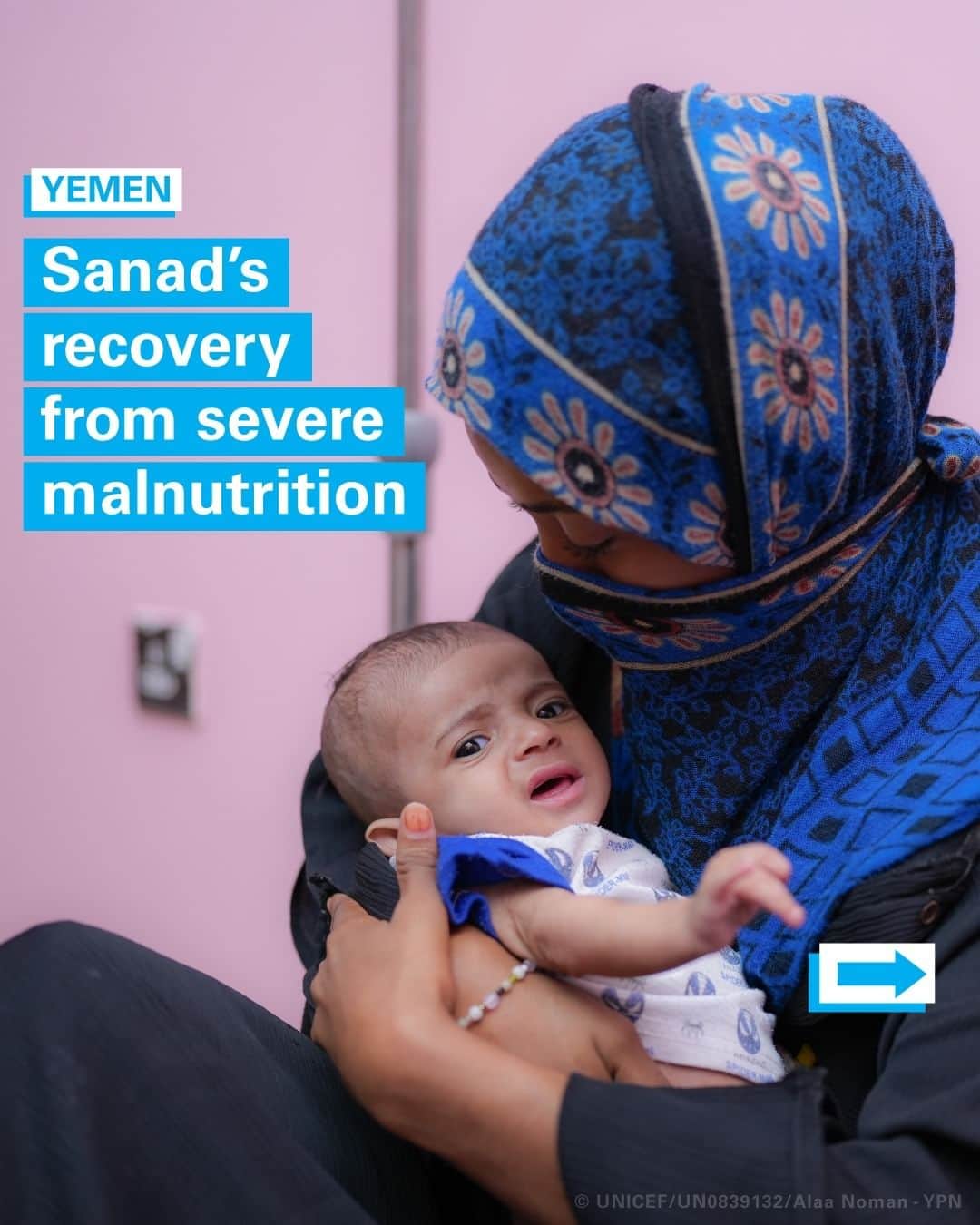 unicefのインスタグラム：「Baby Sanad was skeletal, screaming from hunger and getting sicker by the day in Yemen.   In desperation, his mother Raneem raced him to a UNICEF- and WHO-supported hospital where he was given therapeutic milk and medicine to jump-start his recovery.  At home, he ate ready-to-use therapeutic food, a paste packed full of calories, nutrients and vitamins, which helped him gain weight.   Thanks to the medical care Sanad has been receiving, he’s now significantly healthier. “I can’t believe he’s recovered so well,” says Raneem.  Sanad’s story is one that’s familiar to millions of children and their families globally. But with the right support, change is possible.    Ahead of a major Food Security Summit on 20 November, UNICEF is calling on leaders to urgently invest in the prevention, detection and treatment of severe malnutrition.」