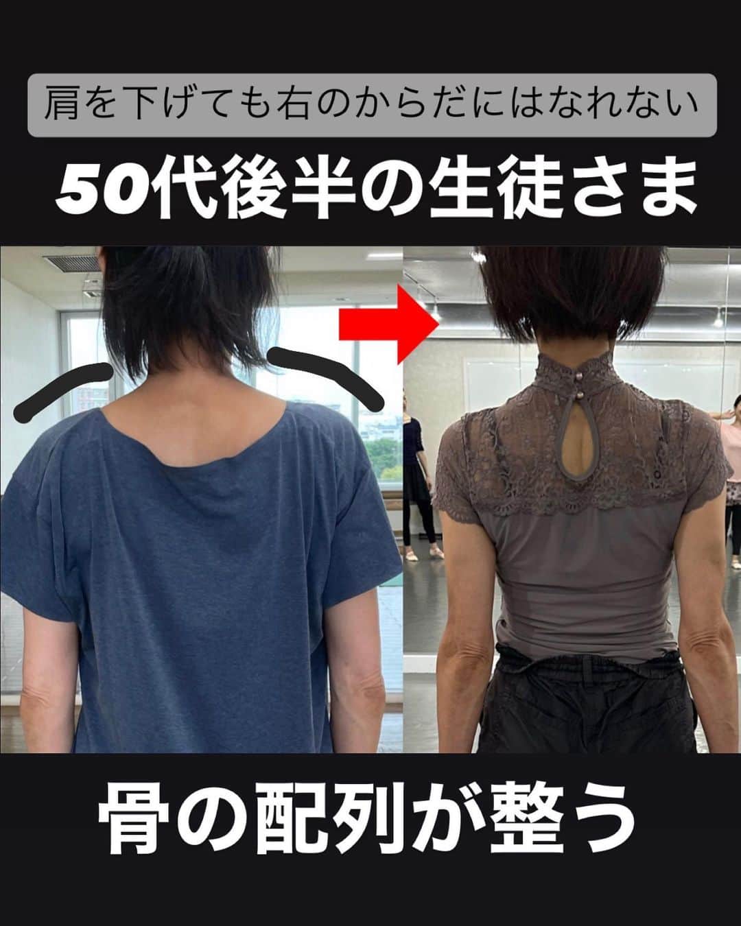 佐川裕香さんのインスタグラム写真 - (佐川裕香Instagram)「『首・見え方も変わる』  首の骨は約7つ  “同じ人でも首の長さが短く、長くも見えます“  この首を長く見せる方法として 顎を引く、胸を張る、肩を下げるなどでは 改善しません。  からだも積み木のように 下が崩れると上も崩れる⇔その反対も  この問題を首だけ、また上半身だけでも 根本的に改善することは難しく  というのも頭の重さはボーリングの玉程度の重さがあります。  この頭の真下に首があると安定して重みを支えられますが、頭が身体よりも前に突き出した状態を維持し続けることで、首の筋肉を常に緊張状態に..ストレートネックへ  首・肩こりや腰痛の不調 また顔が大きく、首も太く短く見えたりとボディラインの崩れのお悩みにも  （実際に以前の私は酷いストレートネック、猫背、首・肩まわりが異常にぼっこりしていました。）  首だから首。ではなく 足元から頭まで全身で調整していく必要があります。  その方法を 今月の月額オンラインレッスンでは 通常のレッスンに＋プラス 11月29日に『足』に集中した特別レッスンを開催  ※アーカイブはレッスン日より2ヶ月間残ります  この機会に、お待ちしております✨  ↓ ↓  期間限定！お申込み受付け ▶︎11月5日(日)23:59まで‼️  プロフィールのURL、MOSHサイトから お申込み受付けさせて頂きます  --------------------------------------------  ✔︎お申込みいただいたその日から 過去２ヶ月分のレッスンアーカイブを視聴可能 ✔︎9割以上の方がアーカイブのみでご参加下さっています  --------------------------------------------  We are accepting applications for monthly online lessons! For more information, please visit the instgram URL✨  https://mosh.jp/services/107752  Languages are here ●Subtitle languages↓ *May be English only in some areas  English/한국어/繁體中文/‎العربية/Italiano Bahasa Indonesia/Svenska/Español/ไทย/Deutsch/Türkçe Français/Tiếng Việ/ Português/Русский  --------------------------------------------」11月2日 19時57分 - yuuka_08