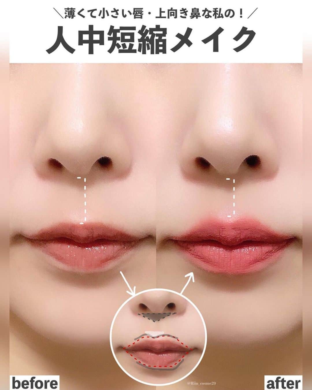 LIPS(リップス)-コスメ・メイク動画さんのインスタグラム写真 - (LIPS(リップス)-コスメ・メイク動画Instagram)「@lipsjp ♡ コスメや美容に関するお悩み・こんな投稿がしてほしい！などのリクエストがあれば、ぜひコメント欄で教えてください❣️  －－－－－－－－－－－－－－－－－－－－－－  ＼脱！のっぺり顔／面長さんにおすすめしたい人中短縮メイク  人中が長いと顔の余白が大きくなって、顔が間伸びして見えたり立体感のないのっぺりした印象になりますよね🥹💦  逆に人中が短いと… ⭕️顔の余白が少なく見えて引き締まった印象に◎ ⭕️若々しくベビーフェイスのように見える👶 などのメリットがあります💡  もちろん人中が長くても綺麗な方はたくさんいるので、決してそれが“美の基準”などではありませんが、もし「面長で人中が長いのを改善したい！」という方がいれば、今回は私が実際にやっている人中短縮メイクの方法をご紹介するのでぜひ試してみてください🫡💖  〜〜〜〜〜〜〜〜〜〜〜〜〜〜〜〜〜〜〜 【人中短縮メイクのやり方】  ①プランパーorリップバームなどで保湿する (下準備の段階でプランパーを使うとこの時点で唇がふっくらなるのでおすすめです◎)  ②リップライナーでオーバーめに縁取る (不自然に見えるため欲張って大きくしすぎないことがポイント💡)  ③②で縁取った唇の内側にリップを塗る  ④唇の山と下側に影を入れる  ⑤④で描いた唇山の影の上にハイライトを入れる  ⑥鼻の下に逆三角形に影を入れる (濃くしてしまうと不自然なのでぼかしたりして馴染ませてください◎)  ＼完成！！／  〜〜〜〜〜〜〜〜〜〜〜〜〜〜〜〜〜〜〜〜〜  人中短縮メイクの大まかなポイントは ［✔️影と光で立体感をつくる］ ［✔️鼻下と上唇の距離を近づけるためにオーバーリップに塗る］  この２つです💡  また、濃くしすぎたり、オーバーにやりすぎると不自然になるのであくまでも［ほんのり手を加える］ことが人中短縮メイクで1番重要です😭👍  人中短縮したくてついつい力が入っちゃいますが、かえって逆効果になるのでそこだけ注意⚠️  また、人の顔の形は本当にさまざまなので自分のお顔とよーーく向き合ってどこが足りないのか、どこを足したいかを分析することも大切です🥹👍  なので、今回紹介したやり方も参考程度にして「すべてをそっくりそのままやる」というよりは、「このやり方は取り入れて、ここはやらなくていい」といった風にご自身で取捨選択して挑戦するのも全然アリです☺️⭕️  人中の長さが気になる！印象を変えたい！と思ってる方はぜひ人中短縮メイクをやってみてください🫶  All Contents From：𝑹𝒊𝒊𝒏  #lipscosme #人中短縮 #人中短縮メイク #メイクの仕方 #メイクテク #メイク講座 #メイク方法 #メイク術 #メイク初心者 #面長解消 #面長メイク #整形級メイク #整形メイク #プチプラコスメ #makeup #cosmetics #beauty #メイク #コスメ #美容 #コスメ好きさんと繋がりたい #コスメ紹介 #コスメレポ #コスメ購入品 #毎日メイク #ナチュラルメイク #化粧品 #垢抜けメイク #初心者メイク #コスメがわかるハッシュタグ」11月4日 21時00分 - lipsjp