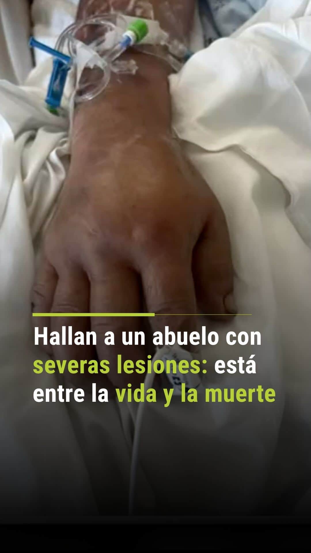 Primer Impactoのインスタグラム：「Hallan a un abuelo con severas lesiones y ahora se debate entre la vida y la muerte.  Su familia pide encontrar al responsable.  Reporta @salduran.   📺 Más en Primer Impacto a las 5pm/ 4C de lunes a viernes por @univision  #PrimerImpaco #accidentes #crimen #California」