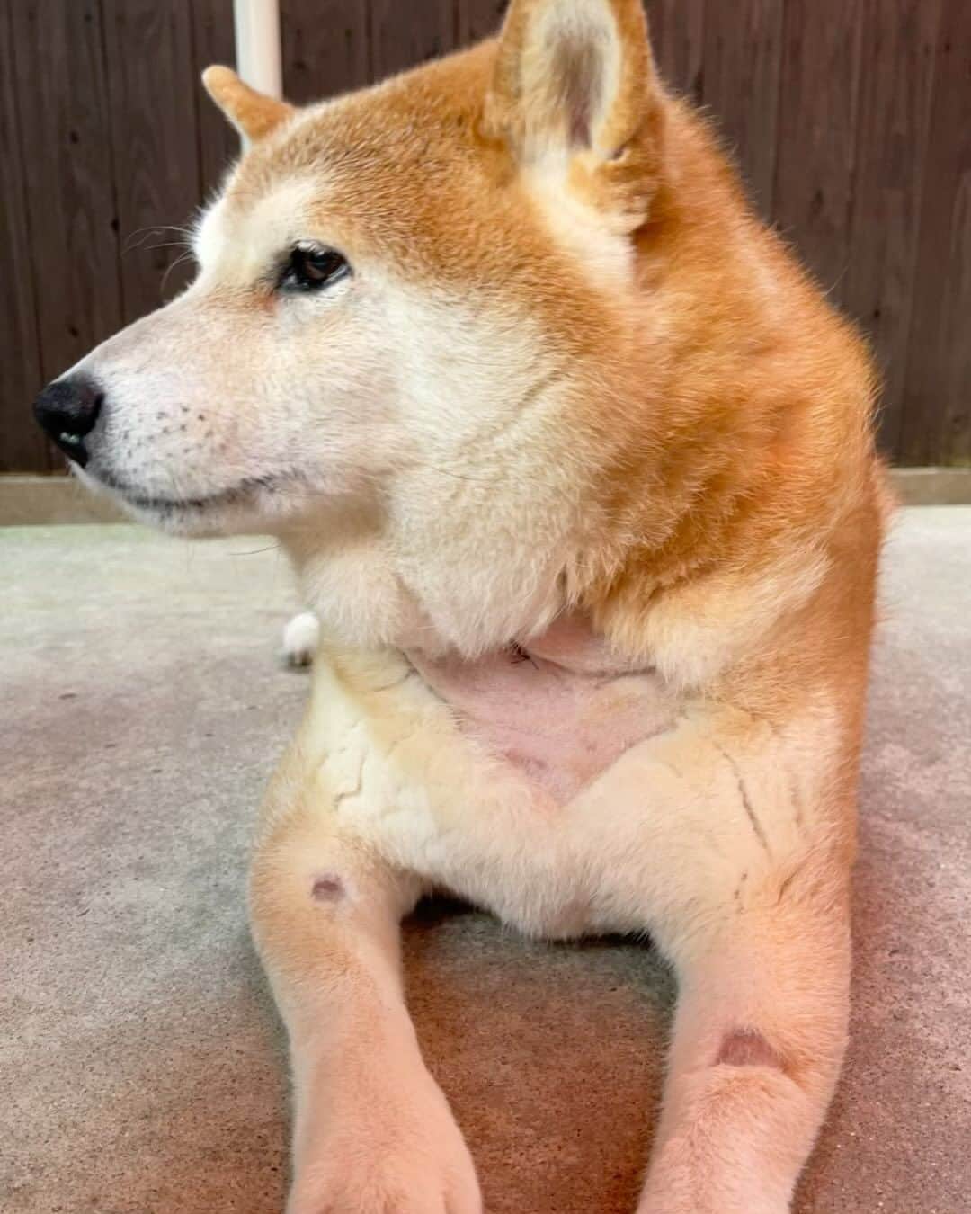 柴犬 たろのインスタグラム：「ただいまー❤️🐕帰って来たよー🐶 無事に退院しました。  みんなのパワーもらったから🐻 頑張ったよー💪  上皮小体腺腫、とりあえず良性 ただし、疑惑が残る結果なので 経過観察が必要🫠  カルシウムの数値は下がり過ぎることなく 今のところ正常値で落ち着いてる  問題は、器官虚脱、😮‍💨かなり酷くなってる  以上、今日の報告です。  応援📣ありがとうございました。  引き続きよろしくお願いします🙇」