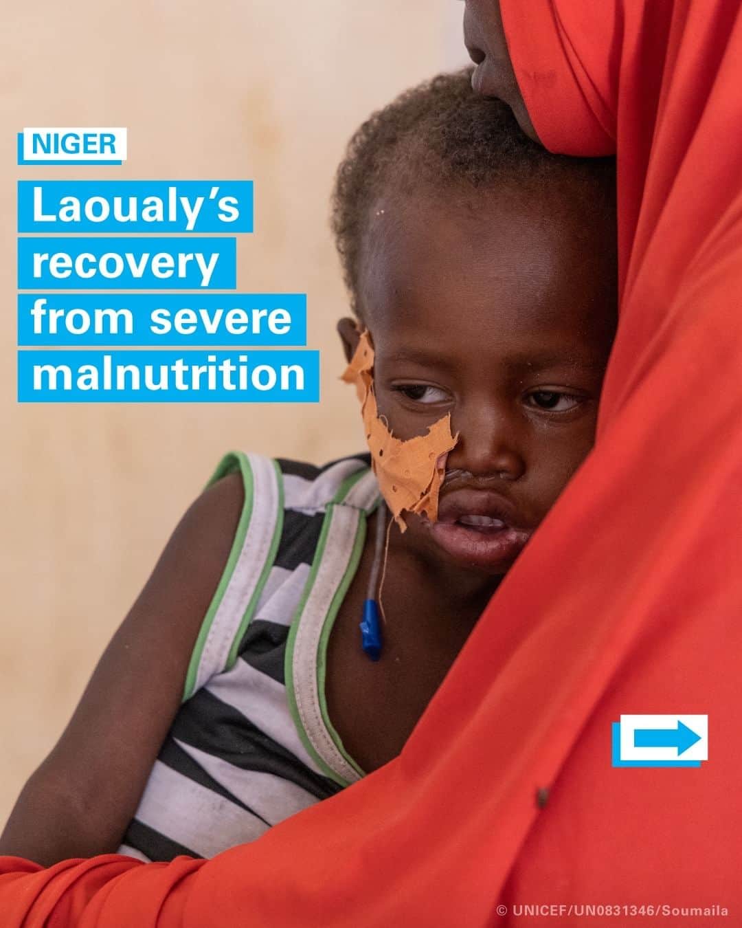 unicefのインスタグラム：「Laoualy, 2, was so ill, he couldn’t stand up.    His grandmother, Sahoura, was worried he wouldn’t pull through, rushing him to a UNICEF-supported hospital in Niger where he was diagnosed with severe malnutrition.  Dedicated healthcare, therapeutic milk, medicine and ready-to-use therapeutic food not only helped get Laoualy back on his feet, but smiling, eating and playing again.    To stop the same thing from happening to other children, UNICEF calls for urgent investment to treat, detect, and prevent severe malnutrition.  This includes support for breastfeeding, micronutrient supplements, therapeutic milk and food, and access to quality nutrition services.    Find out more through the link in our bio.」
