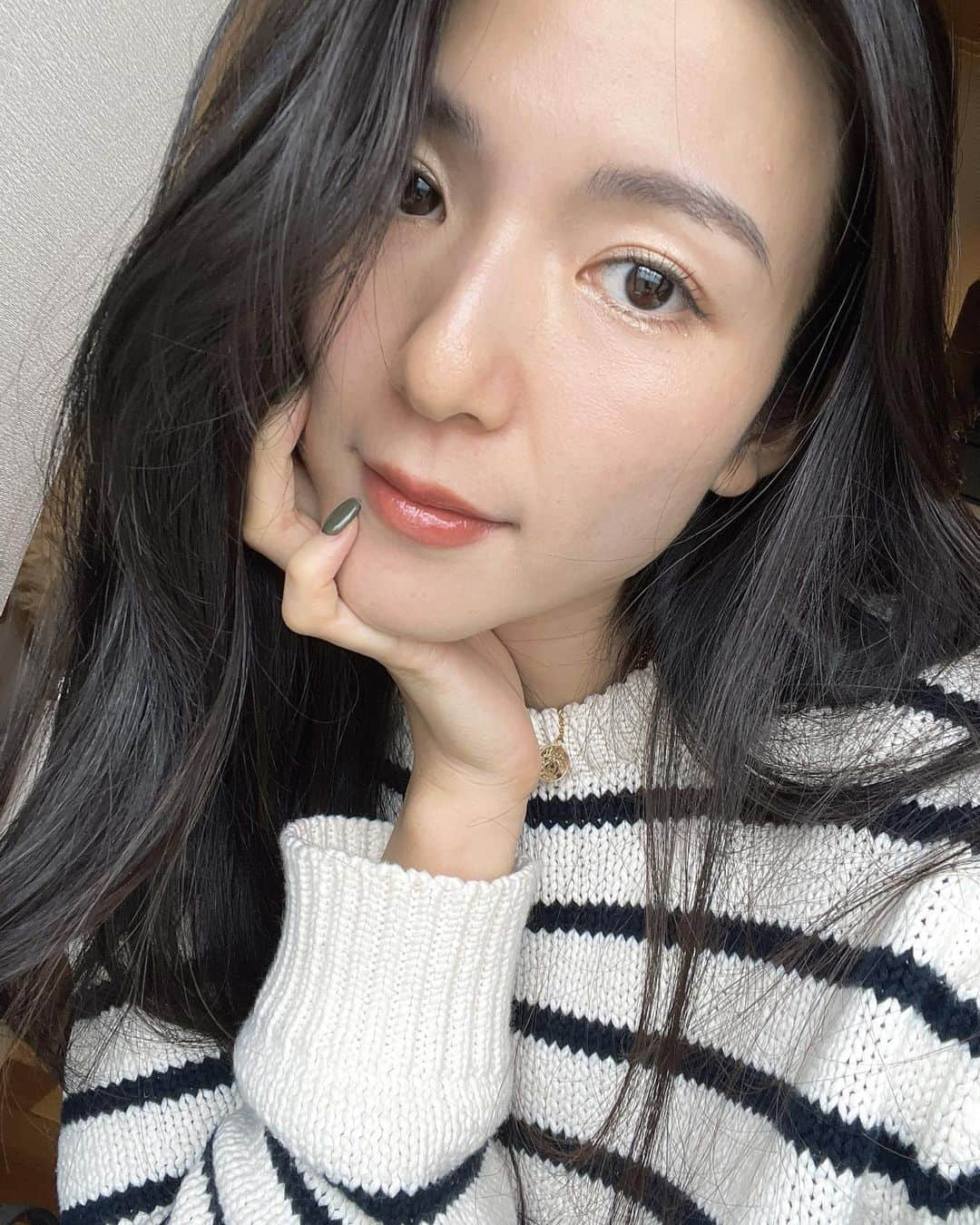 淡輪優希さんのインスタグラム写真 - (淡輪優希Instagram)「お自撮り失礼します←  少し前に @the_roppongi_clinic で #ピコフラクショナル 2回目を受けました！  前回より全体的に強めに照射してもらったので今度はガッツリダウンタイムを経験🙆‍♀️とは言っても数日後からお化粧したらわからないし(でもヨレやすいです)、 @dr.sayakanagao 先生のご説明通り1週間ですっぴんでもほぼわからなくなりました！  そして手に入れたのは以前より断然トーンアップしたお肌🥹👍✨ 私はシミよりも毛穴の開きやニキビ跡が気になったのでそちらを重点的に照射してもらい、1週間は真っ赤なお顔とお付き合いしましたが(※3枚目は施術翌日)、いつかの目標としている"日焼け止めのみ"で生活できる肌にまた一歩近づけました！  毎度の如く、さやか先生の診察が的確すぎて。肌を見ただけで私のズボラスキンケアを見抜かれてしまい、、さすがすぎました。笑  実は乾燥肌なのもあって、油を取りすぎてはよくないと思い、朝は結構な頻度で洗顔せず水やお湯で流すだけで終わらせることが多かったのですが(面倒なのも相まって笑)、まさかの肌質にそのせいで良くない傾向が出ていたみたいで、ズバリそれを言い当てられてしまい、大大反省。笑笑  これからは朝もちゃんと泡洗顔します🫡  でもこれは他の病院では見抜かれたことなかったので、やはりさやか先生はすごい。今の自分に何が必要か、どんな施術が向いているのか、さらには普段のスキンケアまで相談できるので、気になる方はカウンセリングぜひ行ってみてください‼︎✨  #THEROPPONGICLINIC #オーダーメイド治療 #自分史上最高の美」11月5日 21時00分 - yukitannowa