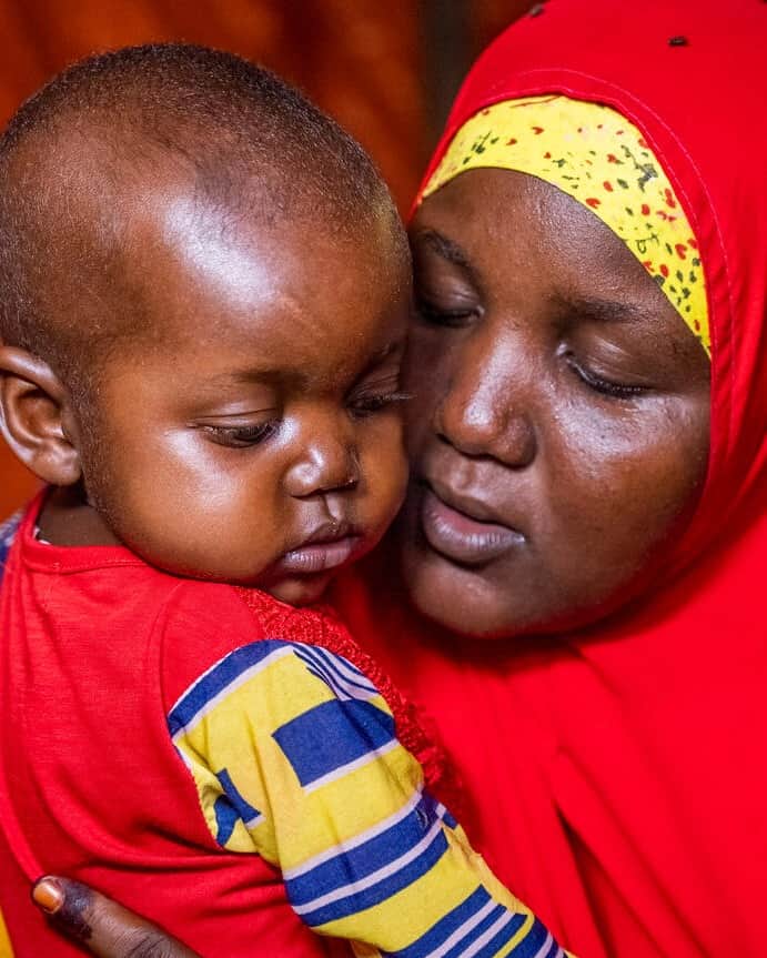 unicefさんのインスタグラム写真 - (unicefInstagram)「A parent’s worst nightmare.  Salaado could see her daughter Luul get sicker and sicker at their make-shift camp for people displaced by drought in Somalia.  Underweight, swollen, and unable to sleep or to stop crying, Luul was diagnosed with severe malnutrition at a health centre.  Therapeutic milk and a paste full of calories and nutrients called ready-to-use therapeutic food provided by UNICEF helped her recover.    “There’s a huge difference between today and when she was first admitted to the hospital,” says Salaado. “She has now regained her strength. I’m so grateful.”    We believe in a world where no parent or child suffers the way Salaado and Luul did.    That’s why we’re calling on governments to support the Child Nutrition Fund, a new coalition to help scale up the detection, treatment and prevention of severe malnutrition for every child.   Tap the link in our bio to find out more.」11月6日 23時04分 - unicef