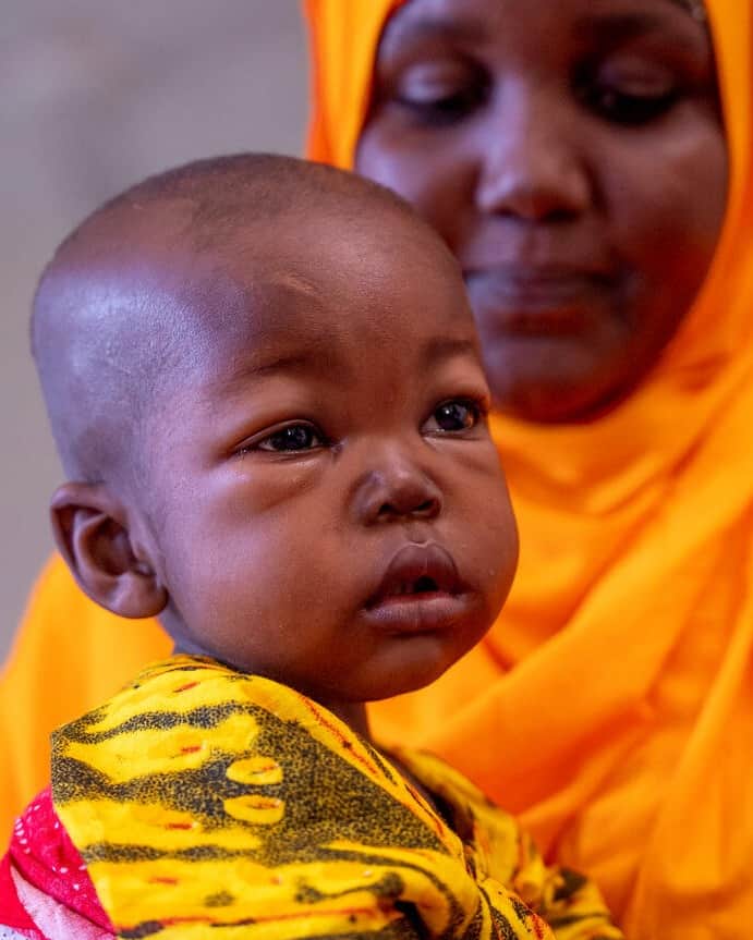 unicefのインスタグラム：「A parent’s worst nightmare.  Salaado could see her daughter Luul get sicker and sicker at their make-shift camp for people displaced by drought in Somalia.  Underweight, swollen, and unable to sleep or to stop crying, Luul was diagnosed with severe malnutrition at a health centre.  Therapeutic milk and a paste full of calories and nutrients called ready-to-use therapeutic food provided by UNICEF helped her recover.    “There’s a huge difference between today and when she was first admitted to the hospital,” says Salaado. “She has now regained her strength. I’m so grateful.”    We believe in a world where no parent or child suffers the way Salaado and Luul did.    That’s why we’re calling on governments to support the Child Nutrition Fund, a new coalition to help scale up the detection, treatment and prevention of severe malnutrition for every child.   Tap the link in our bio to find out more.」