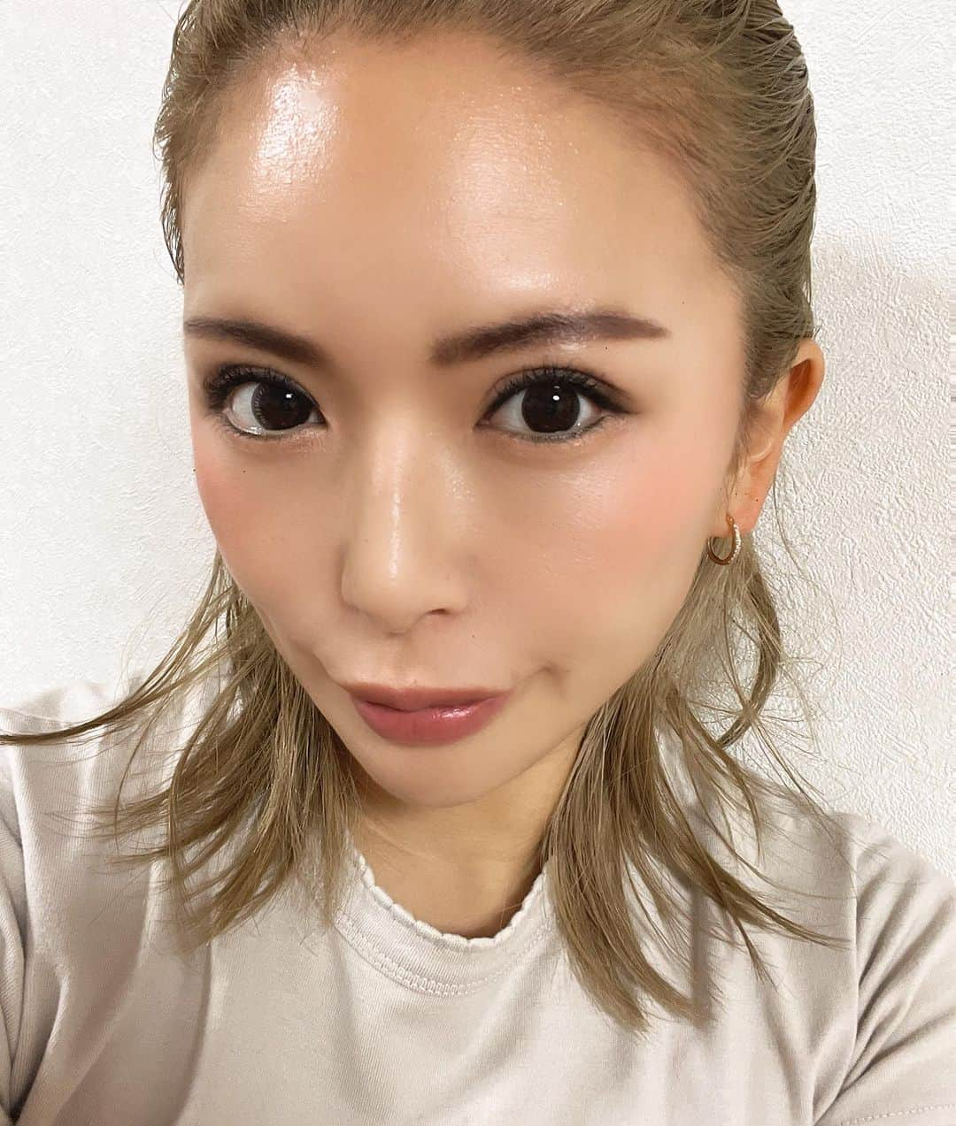 松川めぐみのインスタグラム：「唇ヒアルロン酸３日目。 あざが目立たなくなってきた。  母に会ったら えー！痛くなかった？硬いのー？？ て、下唇ツンツンツンツン👉w いや、わたくし 上唇しかヒアルロン酸 いれておりませんから🤣🤣🤣  口角上げたくて それを意識でぶち込んでます。 アヒル口に憧れております、はい🤣  #唇 #唇ヒアルロン酸 #唇ヒアルロン酸 #唇ヒアル #唇ヒアルロン酸注射 #唇ヒアルロン酸注入 #唇ヒアルロン酸💋 #ダウンタイム  #韓国　#韓国旅行 #韓国好きな人と繋がりたい #美容整形 #美容整形レビュー #整形旅行　#アヒル口 #アヒル口ヒアルロン酸注入 #口角 #口角キュキュッと部 #口角ボトックス #口角挙上 #口角アップ #口角を上げる」