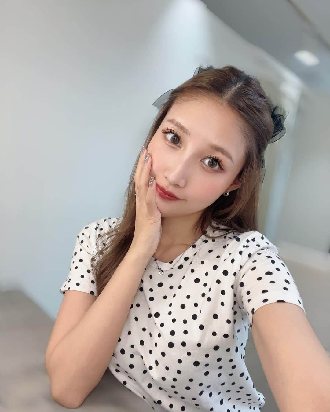 RINAのインスタグラム：「@a_clinic_ginza でAスレッドをしてから２週間程経ちました😆担当の @aclinic_hasegawa 先生のすご腕のおかげで輪郭がきれいな卵型になったの🥚 強めに引き上げてもらったからすこーし内出血したけど気にならなかったヨ👌 とりあえずメイクのときシェーディングいれるのやめました（笑） たるみや顔がなかなか痩せない方、浮腫みやすい方にオススメおん🙌 ・ #aスレッド #糸リフト #aclinic #aclinic銀座 #aclinic横浜 #aclinic新宿 #aclinic名古屋  #aclinic大阪 #aclinic福岡 #aclinic池袋 #aクリニック #エークリニック #小顔  #リフトアップ #美容外科 #美容皮膚科 #美容クリニック #スレッドリフト #小顔整形 #たるみ改善 #長谷川光」