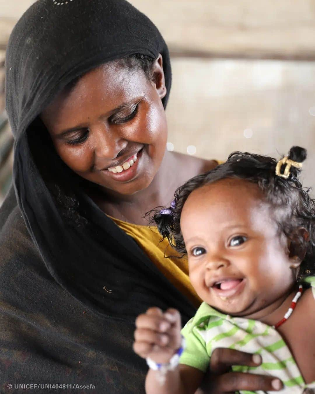 unicefさんのインスタグラム写真 - (unicefInstagram)「When we first met six-month-old Medina in Ethiopia, she was lying motionless on a hospital bed, barely able to open her eyes.  Her mother Amina was having trouble breastfeeding, fearfully watching as Medina’s strength ebbed away.  Amina and her husband had recently fled severe drought to a camp in Afar, Ethiopia.  They had already lost their home and their cattle. Now, they faced the heart-wrenching prospect of losing their daughter.  Doctors at the UNICEF-supported hospital immediately recognised signs of severe malnutrition and took urgent action.  To help her regain strength, Medina was given UNICEF-supplied therapeutic milk and ready-to-use therapeutic food, a nutrient-rich paste which she was able to take at home along with breastmilk.  Soon enough, she was able to sit up and smile again. Within a few months, she was back to a more normal weight.  Through climate change and conflict, UNICEF is delivering its largest nutrition response on record.  Continued funding and support are needed to make sure we can continue expanding our work to prevent, detect and treat deadly severe malnutrition.  Learn more through the link in our bio.」11月8日 23時46分 - unicef