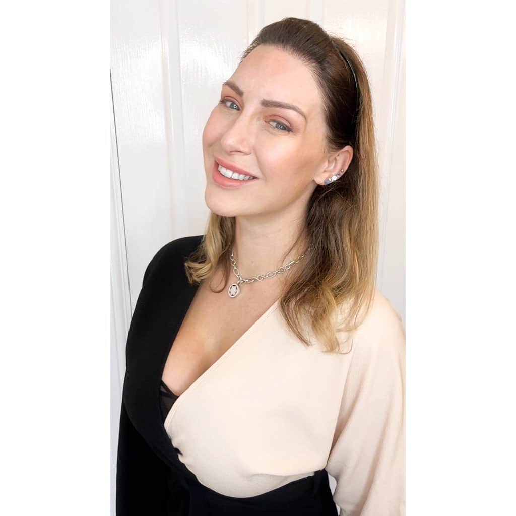 トレーシー・キスのインスタグラム：「Happy Hairiversary to me! It's my one year post hair transplant surgery!💆🏼‍♀️💛 Swipe for my before and after pics 👉🏻  One year ago my life changed forever when I flew to Istanbul in Turkey with @getmorehair.co.uk to have surgery at @cosmedicaclinic with the incredible @dr.leventacar 🌟   After having my second child 11yrs ago my hair noticeably began to thin and recede, and teamed with years of bleaching and heat damage from hair styling and mistreating my hair, in time there was less and less of it left!   Being Hungarian Irish literally everybody in my immediate family struggles with hair, my father lost all of his at the age of 21yrs and my brother just about clung onto it until his 30's before braving the shave. With my mother going through cancer and losing her hair, having thinning and receding myself seemed so insignificant in comparison and so I just didn't talk to anyone about it and tried my best to hide it instead.  Men and women alike face the heartache of hairloss at any age and stage of life, yet we stay silent, feel ashamed and try to hide it which only prolongs the suffering by avoiding the cause. Why hide something that can so easily be fixed? If you want to fix it then surely you should have the choice? Not so long ago, female hair transplants didn't exist, but I'm here to let you know that now they do.   If you want to know more about my journey simply search "hair transplant" on tracykiss.com where I document the entire process in great detail.   Thank you to the team for being so fantastic abd giving me a thick and full permanent hairline that can never fall out or recede. No amount of words can do justice for the difference that it has made to the heartache of living in silence with female hairloss for a decade. Let us all feel able to speak up about the challenges that we face to educate, inform and assist others, as well as ourselves, in this incredible journey through life. You are not alone, there is hope for hairloss 🙏🏼  #hairline #hairtransformation #recedinghairline #hairloss #hairtransplant #femalehairtransplant」