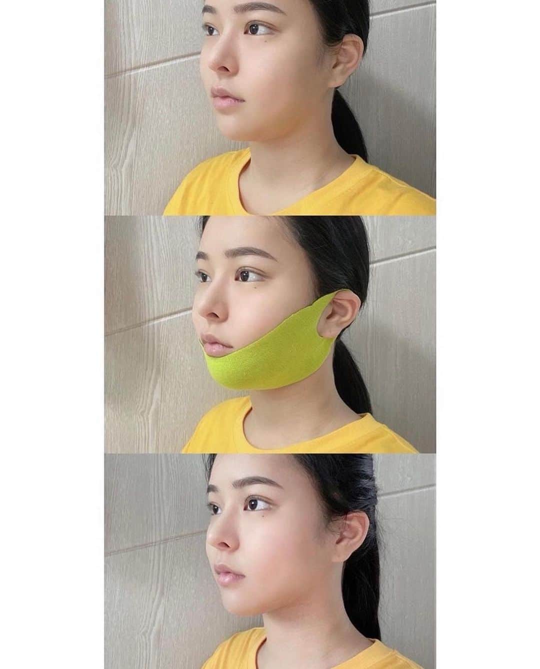 ダユンさんのインスタグラム写真 - (ダユンInstagram)「이제는 효과, 재구매율 등 말해뭐해 입 아픈 수준 여러분들의 효과 인증샷이 저의 3년 전 엔드라이브부터 지금 폰 앨범까지 한 2만 장은 족히 넘는 것 같아요 🫣  = 지금은 여러분들이 보내주신 효과 쩌는 전후 사진들 저장 할 공간조차 부족하다는 사실 (제가 3년 동안 쓴 아이폰 용량들 다 256GB인데… ‼️)  정말 많은 분들이 리프팅 패치 떨어졌다고 ⠀ 발 동동 구르고 계신다고 폭풍 DM받아서⠀  📅 31차 공구 open 했습니다  ⠀ = 구매 방법은 프로필 링크 들어가서 구매 가능합니당   혹시 리프팅 패치 전 후⠀ 저보다 더 심각하게 차이나는 분들 계시나요? 🌝⠀ ⠀⠀ 저는 거의 3년이 넘도록 리프팅 패치 쓰고 있는데⠀ 항상 효과가 이렇게 놀랍도록 좋다는게 정말 놀랄 노자  그래서⠀ 기존 구매자 분들의 재구매율이 항상 솟구치나봐요 🔥⠀ ⠀ 첫 공구 때 구매자 분들이⠀ 3년이 지난 지금도 꾸준히 구매해 주신답니당 ⠀ 늘 감사해요 🙏🏻❤️⠀ 3년 간 꾸준하게 냉장고를 한 칸을 지키고 있지요   + 리프팅 밴드 정보 ⠀ 더블텐션 - 얼굴 전체와 이중턱 안쪽까지 깊게 리프팅 핑크 - 펩타이드 성분이 들어가서 탄력에 효과 연두 - 시카 성분이 들어가서 재생 진정 효과 흰색 - 히알루론 성분이 들어가서 수분 공급 효과  + 리프팅 효과 ⠀ 더블텐션>핑크=연두> 흰색  ❤️더블 텐션은 기존 리프팅 밴드보다 압박감이 강해서  귀빠짐이 있을 수 있습니다  사용 전 밴드 내 사용 방법을 참고 부탁드립니다 🙏🏻  중요한 외출 전 날 자기 전에 1시간 착용해 주기 다음 날 예뻐야 하는 날이 있으면 1번 방법하고 같이 써주면 완벽 그 자체 ⠀ 시봉 크림 바르고 리프팅 밴드 착용하고 그 위에 시봉으로 5-10분 마사지해주면 다음 날 무적 완벽 그 자체 ...... ⠀ + 우리가 평소에 똑같이 쓰는 기초 제품들도 시봉으로 발라주면 효과가 완전 다르다는 사실 ❗️ ⠀ + 지긋지긋한 속건조도 잡아주고 물광까지 덤으로 효과를 볼 수 있어요  📅 11월 10일 31차 마켓 마감입니닷!  ⠀ #스케덤 #리프팅패치 #시봉 #갈바닉 #리프팅밴드」11月8日 19時08分 - 2__yun__2