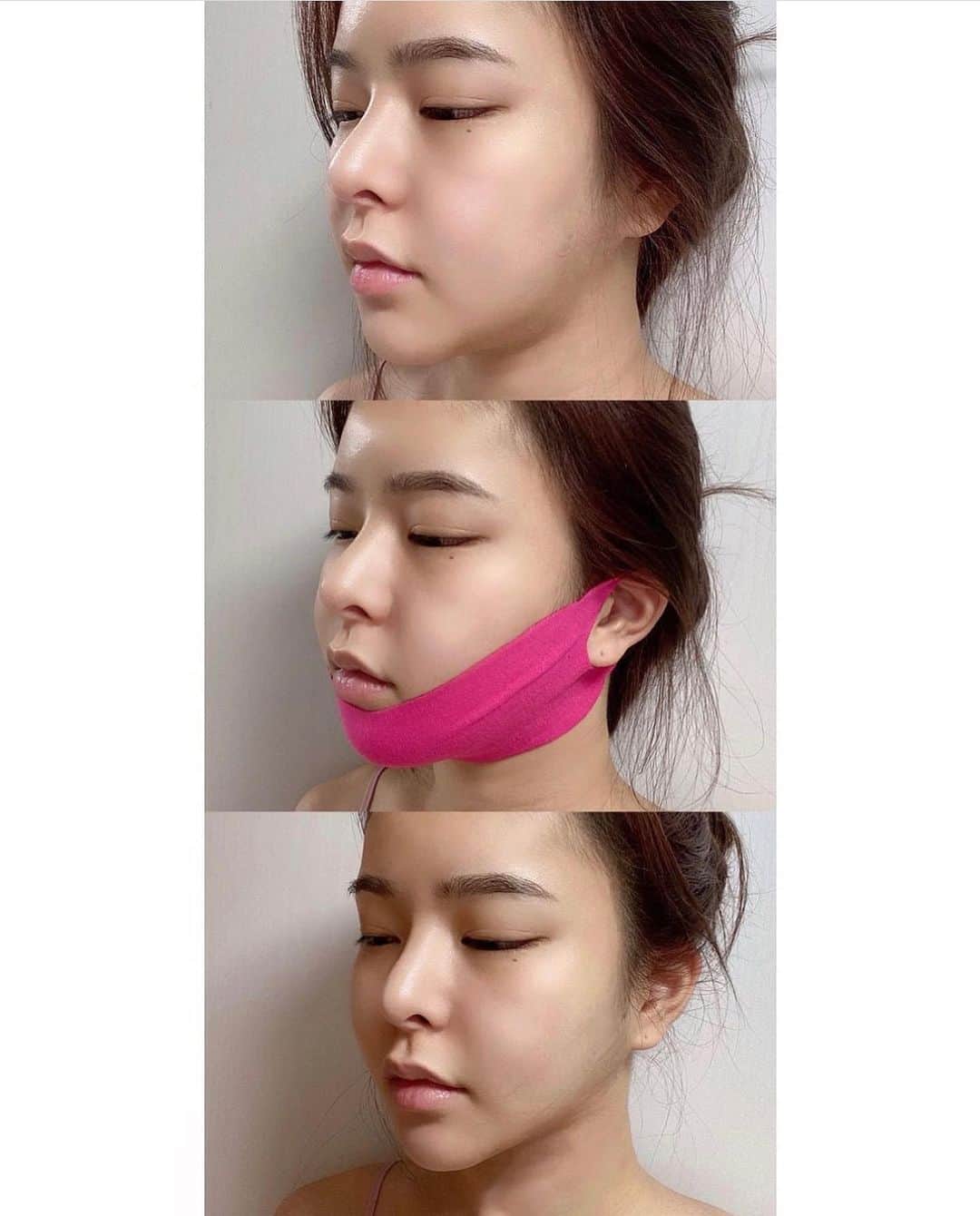 ダユンさんのインスタグラム写真 - (ダユンInstagram)「이제는 효과, 재구매율 등 말해뭐해 입 아픈 수준 여러분들의 효과 인증샷이 저의 3년 전 엔드라이브부터 지금 폰 앨범까지 한 2만 장은 족히 넘는 것 같아요 🫣  = 지금은 여러분들이 보내주신 효과 쩌는 전후 사진들 저장 할 공간조차 부족하다는 사실 (제가 3년 동안 쓴 아이폰 용량들 다 256GB인데… ‼️)  정말 많은 분들이 리프팅 패치 떨어졌다고 ⠀ 발 동동 구르고 계신다고 폭풍 DM받아서⠀  📅 31차 공구 open 했습니다  ⠀ = 구매 방법은 프로필 링크 들어가서 구매 가능합니당   혹시 리프팅 패치 전 후⠀ 저보다 더 심각하게 차이나는 분들 계시나요? 🌝⠀ ⠀⠀ 저는 거의 3년이 넘도록 리프팅 패치 쓰고 있는데⠀ 항상 효과가 이렇게 놀랍도록 좋다는게 정말 놀랄 노자  그래서⠀ 기존 구매자 분들의 재구매율이 항상 솟구치나봐요 🔥⠀ ⠀ 첫 공구 때 구매자 분들이⠀ 3년이 지난 지금도 꾸준히 구매해 주신답니당 ⠀ 늘 감사해요 🙏🏻❤️⠀ 3년 간 꾸준하게 냉장고를 한 칸을 지키고 있지요   + 리프팅 밴드 정보 ⠀ 더블텐션 - 얼굴 전체와 이중턱 안쪽까지 깊게 리프팅 핑크 - 펩타이드 성분이 들어가서 탄력에 효과 연두 - 시카 성분이 들어가서 재생 진정 효과 흰색 - 히알루론 성분이 들어가서 수분 공급 효과  + 리프팅 효과 ⠀ 더블텐션>핑크=연두> 흰색  ❤️더블 텐션은 기존 리프팅 밴드보다 압박감이 강해서  귀빠짐이 있을 수 있습니다  사용 전 밴드 내 사용 방법을 참고 부탁드립니다 🙏🏻  중요한 외출 전 날 자기 전에 1시간 착용해 주기 다음 날 예뻐야 하는 날이 있으면 1번 방법하고 같이 써주면 완벽 그 자체 ⠀ 시봉 크림 바르고 리프팅 밴드 착용하고 그 위에 시봉으로 5-10분 마사지해주면 다음 날 무적 완벽 그 자체 ...... ⠀ + 우리가 평소에 똑같이 쓰는 기초 제품들도 시봉으로 발라주면 효과가 완전 다르다는 사실 ❗️ ⠀ + 지긋지긋한 속건조도 잡아주고 물광까지 덤으로 효과를 볼 수 있어요  📅 11월 10일 31차 마켓 마감입니닷!  ⠀ #스케덤 #리프팅패치 #시봉 #갈바닉 #리프팅밴드」11月8日 19時08分 - 2__yun__2