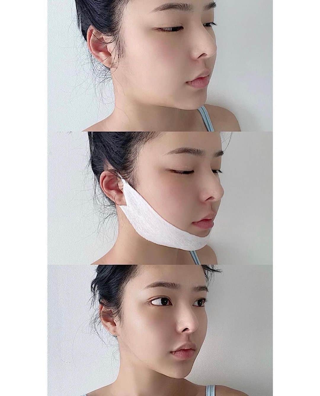 ダユンさんのインスタグラム写真 - (ダユンInstagram)「이제는 효과, 재구매율 등 말해뭐해 입 아픈 수준 여러분들의 효과 인증샷이 저의 3년 전 엔드라이브부터 지금 폰 앨범까지 한 2만 장은 족히 넘는 것 같아요 🫣  = 지금은 여러분들이 보내주신 효과 쩌는 전후 사진들 저장 할 공간조차 부족하다는 사실 (제가 3년 동안 쓴 아이폰 용량들 다 256GB인데… ‼️)  정말 많은 분들이 리프팅 패치 떨어졌다고 ⠀ 발 동동 구르고 계신다고 폭풍 DM받아서⠀  📅 31차 공구 open 했습니다  ⠀ = 구매 방법은 프로필 링크 들어가서 구매 가능합니당   혹시 리프팅 패치 전 후⠀ 저보다 더 심각하게 차이나는 분들 계시나요? 🌝⠀ ⠀⠀ 저는 거의 3년이 넘도록 리프팅 패치 쓰고 있는데⠀ 항상 효과가 이렇게 놀랍도록 좋다는게 정말 놀랄 노자  그래서⠀ 기존 구매자 분들의 재구매율이 항상 솟구치나봐요 🔥⠀ ⠀ 첫 공구 때 구매자 분들이⠀ 3년이 지난 지금도 꾸준히 구매해 주신답니당 ⠀ 늘 감사해요 🙏🏻❤️⠀ 3년 간 꾸준하게 냉장고를 한 칸을 지키고 있지요   + 리프팅 밴드 정보 ⠀ 더블텐션 - 얼굴 전체와 이중턱 안쪽까지 깊게 리프팅 핑크 - 펩타이드 성분이 들어가서 탄력에 효과 연두 - 시카 성분이 들어가서 재생 진정 효과 흰색 - 히알루론 성분이 들어가서 수분 공급 효과  + 리프팅 효과 ⠀ 더블텐션>핑크=연두> 흰색  ❤️더블 텐션은 기존 리프팅 밴드보다 압박감이 강해서  귀빠짐이 있을 수 있습니다  사용 전 밴드 내 사용 방법을 참고 부탁드립니다 🙏🏻  중요한 외출 전 날 자기 전에 1시간 착용해 주기 다음 날 예뻐야 하는 날이 있으면 1번 방법하고 같이 써주면 완벽 그 자체 ⠀ 시봉 크림 바르고 리프팅 밴드 착용하고 그 위에 시봉으로 5-10분 마사지해주면 다음 날 무적 완벽 그 자체 ...... ⠀ + 우리가 평소에 똑같이 쓰는 기초 제품들도 시봉으로 발라주면 효과가 완전 다르다는 사실 ❗️ ⠀ + 지긋지긋한 속건조도 잡아주고 물광까지 덤으로 효과를 볼 수 있어요  📅 11월 10일 31차 마켓 마감입니닷!  ⠀ #스케덤 #리프팅패치 #시봉 #갈바닉 #리프팅밴드」11月8日 19時08分 - 2__yun__2