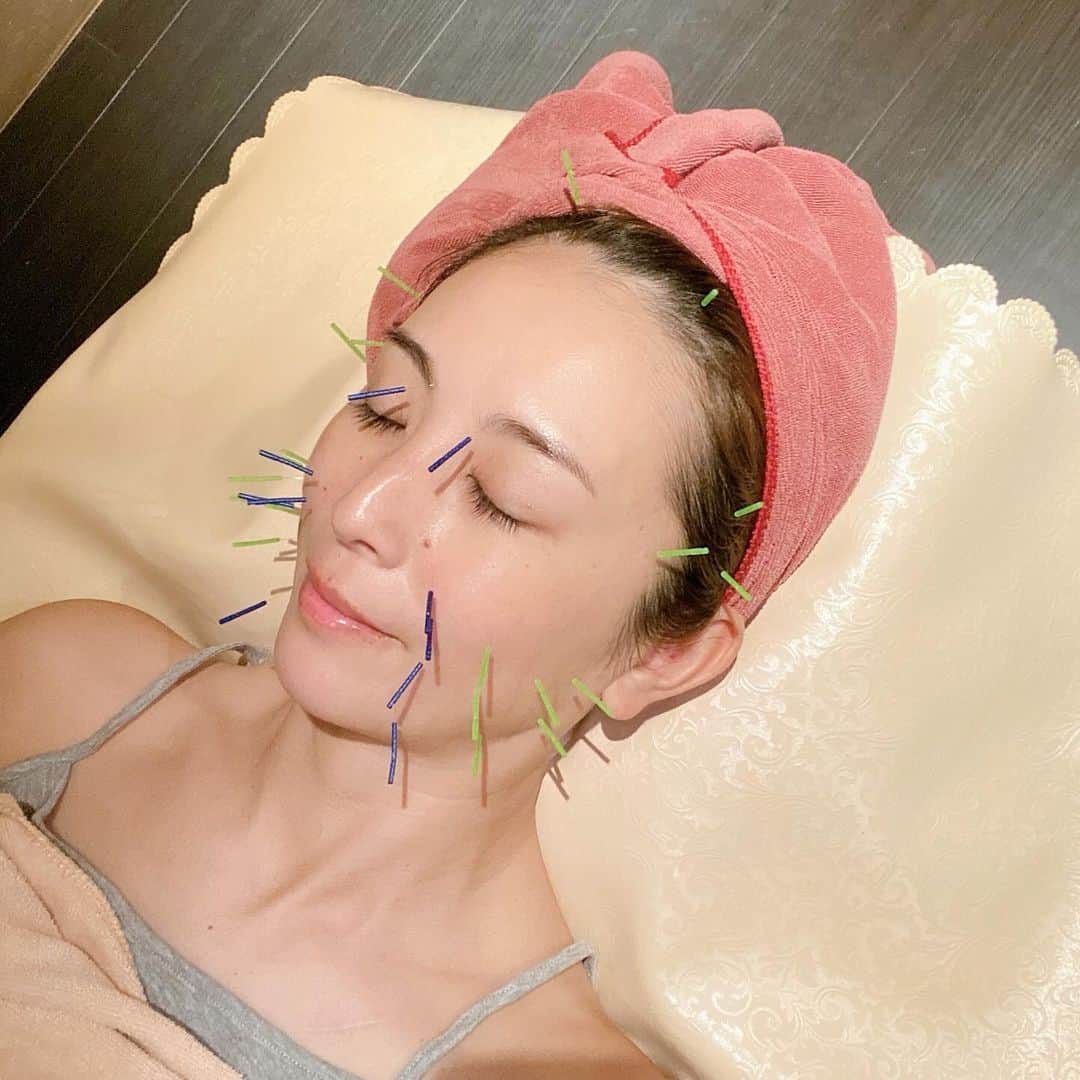 大谷朋子さんのインスタグラム写真 - (大谷朋子Instagram)「♡ * 久しぶりの美容鍼。 鍼灸サロンLa Concier （ラコンシェル）代々木上原店 でお願いしました！ * 美容鍼は、真皮にある、コラーゲン、エラスチン、 ヒアルロン酸などの美肌成分を作り出す線維芽細胞に アプローチ！ 細胞活性化させて、ターンオーバーを促進することで ハリや弾力のある肌に導いてくれます。 * 最近は、しわもたるみも肌のハリのなさも気になっていたけど、1回でも頬の位置が上がって、フェイスラインがシュッとしたのを実感しました！ * 美容鍼のあとは、 プラセンタオイルで肌に栄養を入れていく、 リフトアップトリートメントをしていただきました♡ 首肩、背中、デコルテまでほぐしていただき至福のひととき🕊️ * 首がめちゃくちゃ硬いみたいで、 辛くないですか？と言われてしまった。。 ここ最近ストレスほんとすごくて、 首のコリが慢性的になっているのかも。 定期的にケアしないと！と思いました。 * 終わった後はもうスッキリ〜！ 美容鍼とトリートメントのセットがとてもよかったので おすすめです♡ * * @laconcier_yoyogiuehara #ラコンシェル #美容鍼灸 #代々木上原美容鍼 #美容鍼 #アンチエイジング」11月23日 21時08分 - tomoko_ohtani