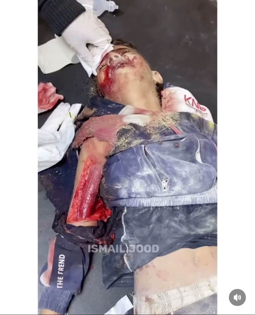 カリム・レキクのインスタグラム：「💔💔💔..🇵🇸🇵🇸🇵🇸」