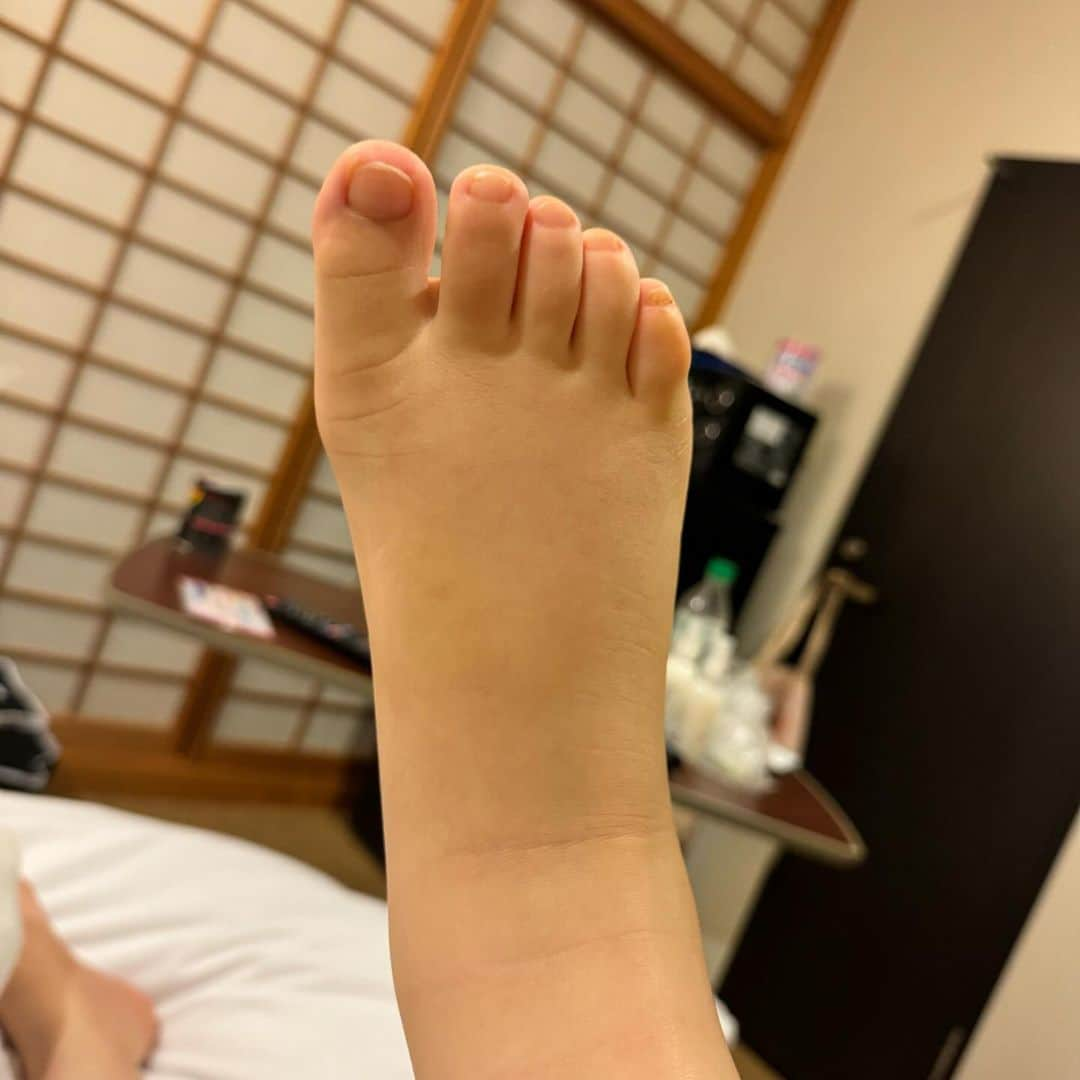 ひよんさんのインスタグラム写真 - (ひよんInstagram)「🦶❤️  本当にあっという間に大きくなってしまった🫣💓 まだ1ヶ月も経ってないけど既に産まれた頃が懐かしい🥹 ゆっくり成長してほしいって気持ちがわかるけど、 早く会話したいな〜って気持ちもある🤣  色んな感情が入り混じっている❤️  3枚目はボンボンじゃなくて私の足だよ🦶笑  #ひよん #新生児」11月9日 16時11分 - cchan_fee4