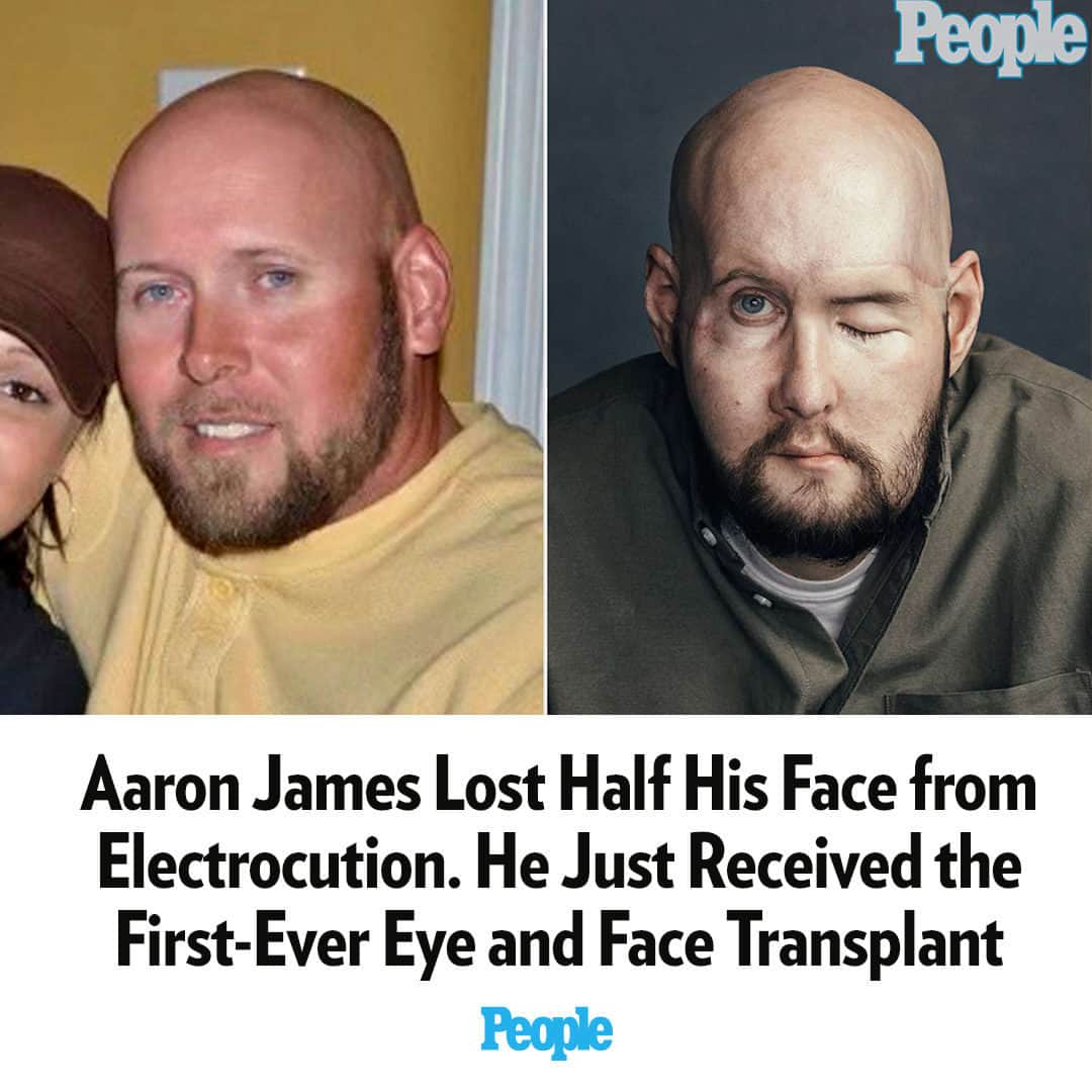 People Magazineのインスタグラム：「Aaron James loves looking in the mirror these days. “I can't go past one without stopping,” says the 46-year-old from Arkansas, turning his head from side to side on a Zoom interview to show off his new face, clearly still in awe by what he sees. “I’m just blown away.” While working as a lineman two years ago, James was electrocuted and lost half his face. In a ground-breaking surgery, doctors gave him a new one — and helped rebuild his life. “For the first time since the accident, I don’t want to wear a mask,” he says. "I want everybody to see me.” Read the full story in our bio link. | 📷: Courtesy of James family; Victoria Will」
