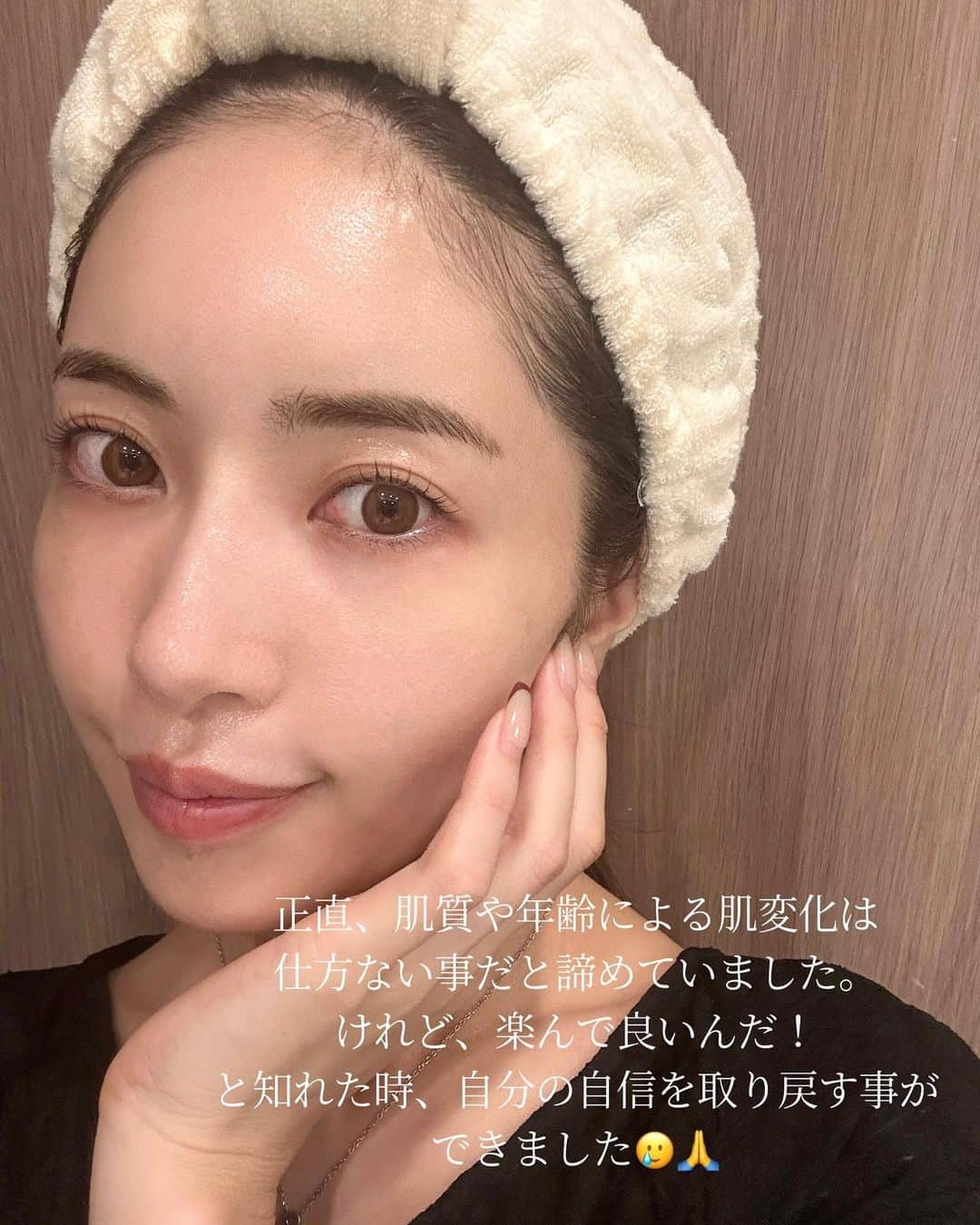 舟山久美子（くみっきー）さんのインスタグラム写真 - (舟山久美子（くみっきー）Instagram)「わたしのお守りのようなフルボ酸との出会いと肌変化の記録を✨  10代からお仕事で忙しい日々を過ごし、20代になるとホルモンバランスの乱れから紫外線アレルギーや慢性炎症に悩み、紫外線を浴びることも、新しいスキンケアを使うことも怖くなっていました。  明日の自分に自信が持てるようになりたくて、何かいいものはないかと探すものの、敏感肌用のスキンケアを使っても肌が赤くなり、理想的な肌状態にたどり着くまでとても試行錯誤する毎日。 そして、産後の肌変化や育児の忙しさも相まって、あきらめかけた時も🥲  そんな時に出逢えた成分が『フルボ酸』です。  フルボ酸は肌の炎症、肌ゆらぎの改善に優れた成分です。 そして肌の土台を整えて本来の健やかな肌に育ててくれます。この出会いからわたしの肌も心も本当に大きく変わったと言っても過言ではありません😭🙏！  わたしが悩み続けてあきらめかけていた慢性炎症肌が克服できたことや、周りから肌を褒められるようになったことが何よりも嬉しく、自分にやっと自信が持てるようになりました😭✨  芸能を初めて17年。商品プロデュースはコスメ、インナーケア、下着、洋服、ウェディングドレスなど、約30社以上と取り組み、自身のアパレルブランドは10年続けました。 その中でも、肌ケアは自分自身と向き合える時間、そして心のケアにも繋がる土台となるものだと感じているので、このフルボ酸という本当に素敵なものをみなさんにお届けしたい気持ちがとても強く、日々一生懸命な気持ちで取り組んでいます🙏  わたしのように、肌悩みは "仕方がないこと" と思っている方も多いのかなと思いますが、少しでも多くの方々の肌悩みの改善のお役に立てればと思っているので、楽しみにお待ちいただけると幸いです！☺️🙏✨ @herzskin  #フルボ酸　#ミネラル #肌炎症　#揺らぎ #肌揺らぎ #スキンケア　#フルボスキン　#skincare  #美容　#敏感肌の克服　#肌荒れ　#エイジングケア　#herzskin肌変化チャレンジ」11月10日 21時34分 - kumikofunayama