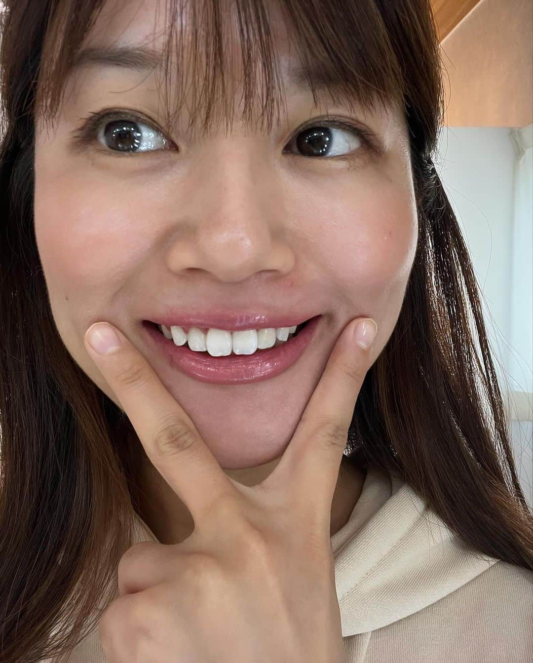 小林礼奈さんのインスタグラム写真 - (小林礼奈Instagram)「新潟市、ホワイトニングビューティー出来島店へ✨ 12トーン→6トーンにひと回り白くなりました！ 半年に1回のメンテナンスだけど1回で白くなるの、毎回😇✌️✨ すごぉーー🦷✨  #ホワイトニング新潟#新潟ホワイトニング#セルフホワイトニング専門店 #PR」11月11日 16時07分 - kobayashi_ayana0218