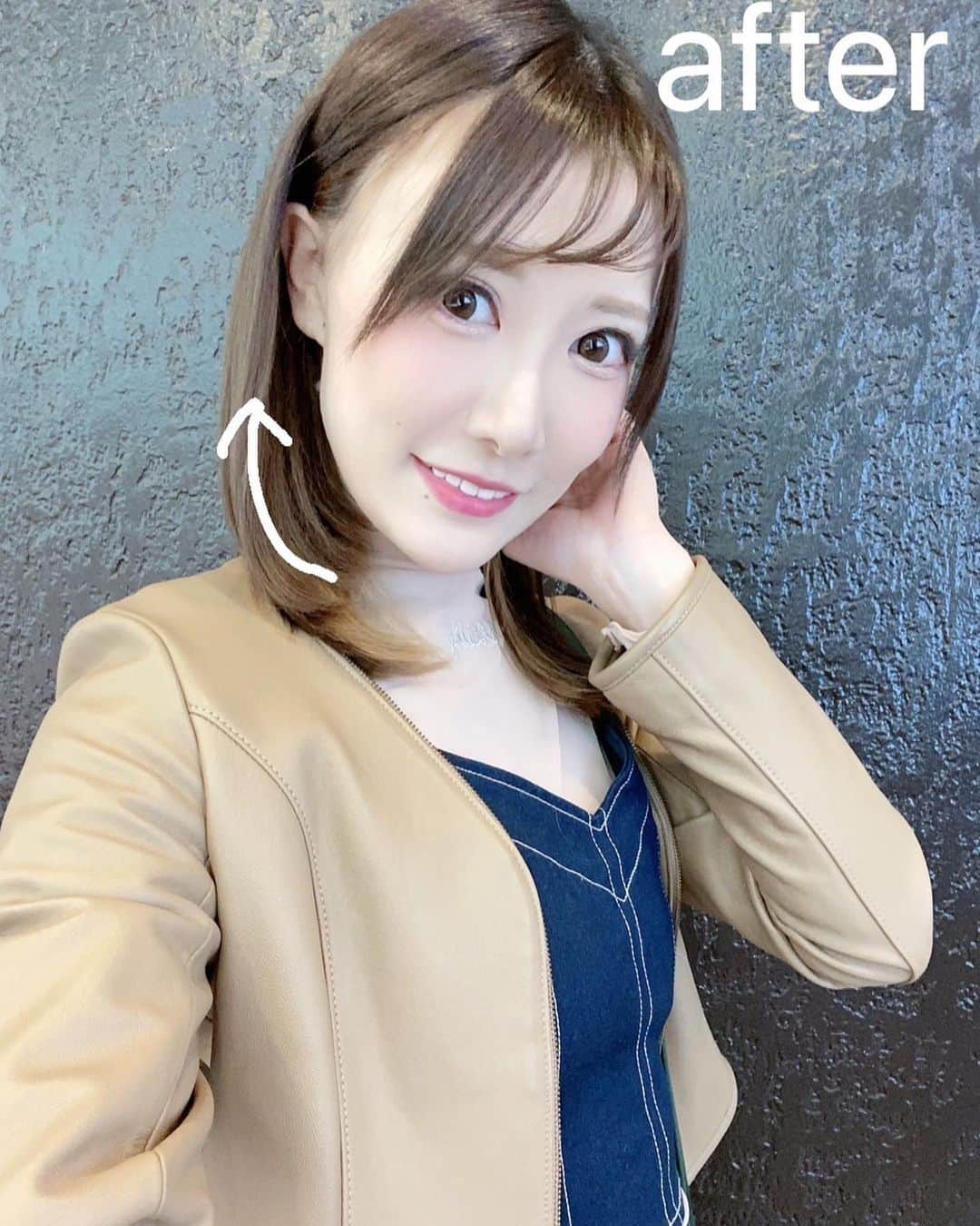 小峰みこさんのインスタグラム写真 - (小峰みこInstagram)「昨日はAクリニック新宿院さん @aclinic_shinjuku にて、片桐先生 @aclinic_katagiri に、フェイスラインのもたつきを改善してもらうためAスレッドをしていただきました！ ビフォアフ見て一目瞭然、ほっぺの横の線が消えた🙌✨ 去年開院したばかりの院内は全てが新しく、清潔感のある内装でリラックスできました！ 片桐先生はテキパキ仕事こなしてくださって、あっという間に施術が終わったよ！ 次は、Aクリニックで期間限定キャンペーン中のポテンツァがすごく気になってるー👀✨  #aスレッド #糸リフト #aclinic #aclinic銀座 #aclinic横浜 #aclinic新宿 #aclinic名古屋 #aclinic大阪 #aclinic福岡#aclinic池袋 #aclinic仙台 #aクリニック #エークリニック #小顔 #スレッドリフト #小顔整形 #たるみ改善   #リフトアップ #美容外科 #美容皮膚科 #美容クリニック #片桐大佑」11月12日 14時14分 - mico_19911201