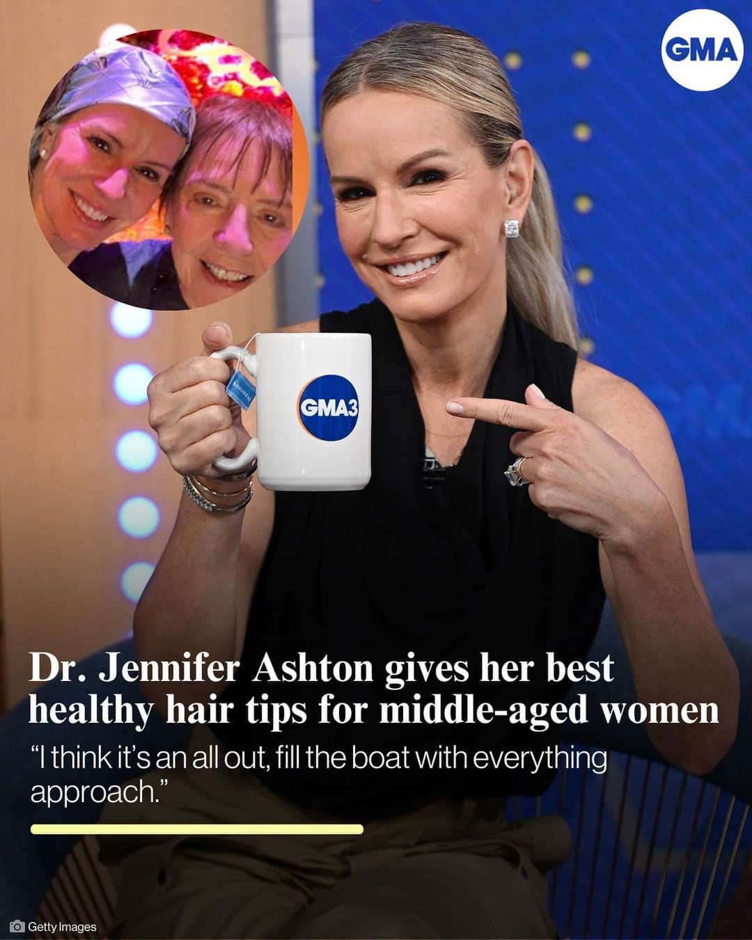 Good Morning Americaのインスタグラム：「@abcnews chief medical correspondent @drjashton breaks down what middle-aged women should know when it comes to hair care practices.」