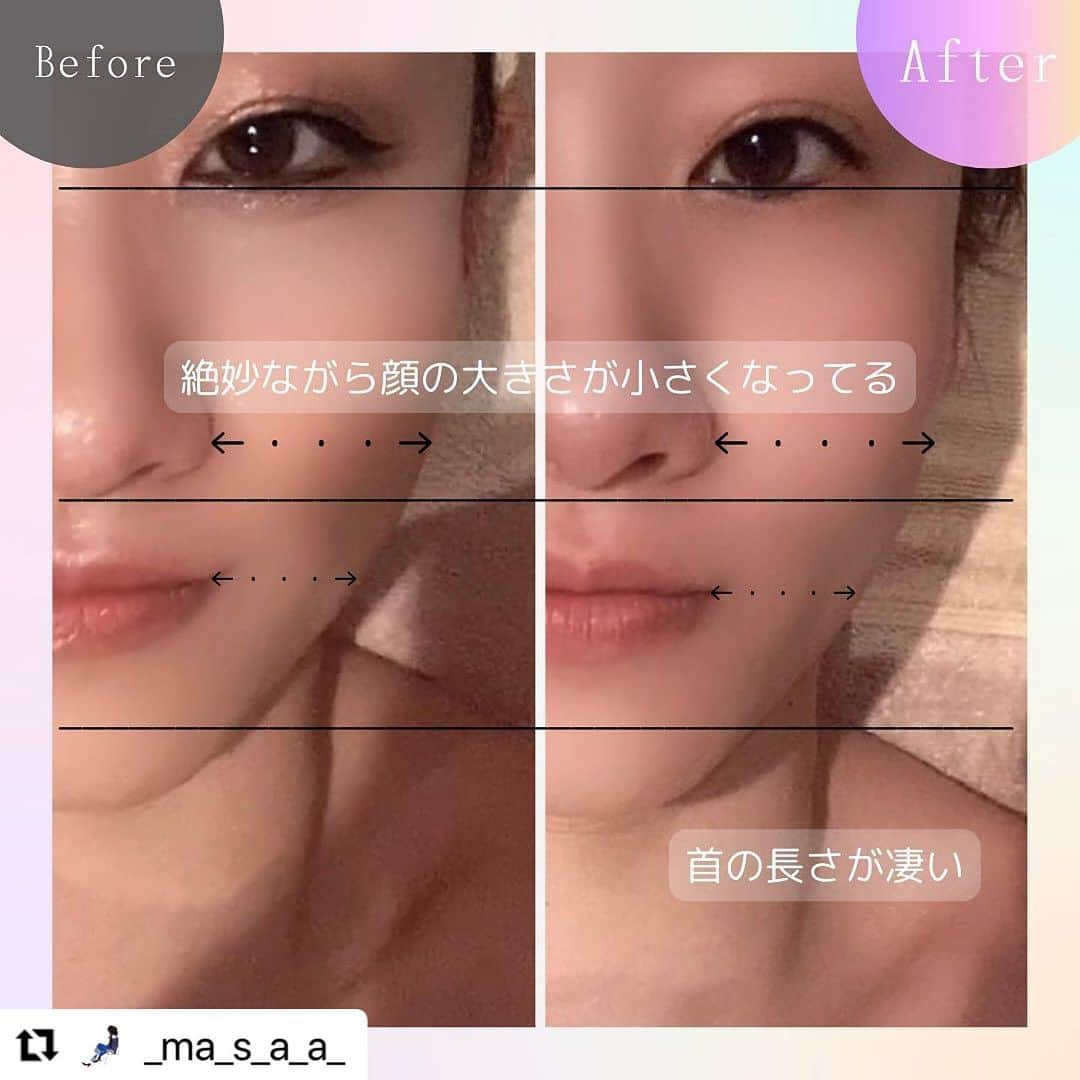 vs28baliさんのインスタグラム写真 - (vs28baliInstagram)「#Repost @_ma_s_a_a_ さま  目黒店へのご来店と素敵な投稿ありがとうございます🎀  スマホやPCに毎日囲まれる生活で 肩首の疲れがずっと続いている方、 目の疲れで視界がスッキリしない方、 フェイスラインのもたつき・二重アゴが気になる方 必見のブレインエイジングフェイシャルコース💗 ぜひ一度ご体験ください😊  ご予約・詳細はプロフィールリンクまたはハイライトからチェック🔗  ・・・ 𓂃𝚌𝚊𝚛𝚎 ・ VS28スキンケアスタジオBALI 目黒店に行ってきました‼️ 基礎化粧品会社EBM直営のスキンケア専門店😊✨ ・ ☑︎ブレインエイジングフェイシャルコース Deepホットクレンジング ↓ ローズオイルトリートメント ↓ 天然ヒアルロン酸+活性水で深層毛穴洗浄 ↓ 毛穴吸引＆角質除去 ↓ SOGANリフトアップ&肩・首トリートメント ↓ ガルヴァーニヘッドケア ↓ 水分補給＆保湿仕上げ ハンドケア・フットリラックスケアも付いてきて、オールハンドの施術で贅沢なひとときを過ごしました💕 ・ 電磁波デトックスって聞いたことある❓ 今の時代、我らは電磁波を受けた生活だけど、ココのサロンのスキンケアを使って電磁波デトックスが出来るって凄いよね🤭⁉️ ヘッドケアで頭の重さや身体のだるさなど解消してくれるうえ、肌もワントーン明るい状態へしてくれる☝️ 寝不足でくすんでた肌が施術後、ワントーン明るくなったのは事実です🤭✨ ・ 鼻の毛穴もキュッとしまった感じがファンデのノリも良くしてくれてメイクしてても嬉しい💕 ・ 今回体験した 【ブレインエイジングフェイシャルコース】約50分 通常価格18,700円→初回体験価格5,500円で受けられます😳✨ ・ このキャンペーンは、全国に40店舗展開しているスキンケアスタジオにて受けられるから近くの店舗を検索してみてね🔍 https://ebm-co.jp/brainaging-first/ ・ ・ ・ #PR @vs28bali #スキンケアスタジオ #イービーエム化粧品 #フェイシャル #毛穴洗浄 #美肌 #ローズガルヴァーニ #ご褒美エステ#サロン #エステサロン #エステ #毛穴ケア #美活 #美意識 #肌ケア #スキンケアスタジオlp」11月15日 12時07分 - vs28bali