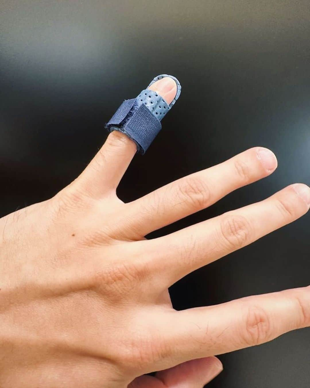 林俊傑さんのインスタグラム写真 - (林俊傑Instagram)「I wish this was a prank, but it's not.  I also wish I had a cooler story to tell, but I’m afraid not… I’ve injured my little finger. While trying to save a falling glass bottle, I accidentally hit my hand, and suffered a torn tendon to my pinky finger, and am unable to straighten it no matter how hard I try. Fortunately, X-Ray showed no sign of bone fracture. However, I will have to be wearing a finger cast from now on, 24/7 for the next 6 weeks, and hope that it will recover! Please do not worry about me, I will brace this and get well, like I always have!  昨天有人好奇我的手指怎麼了？其實我是為了「拯救」掉落的玻璃瓶，尾指肌腱受傷了… 醫生指示接下來6週必須戴著輔助器讓肌腱歸位。所幸筋骨無恙，希望6週以後肌腱能夠順利復原！不用擔心，會好的（一如往常）。  #malletfinger #iwillgetwellsoon #roadtoJJ20」11月15日 23時47分 - jjlin