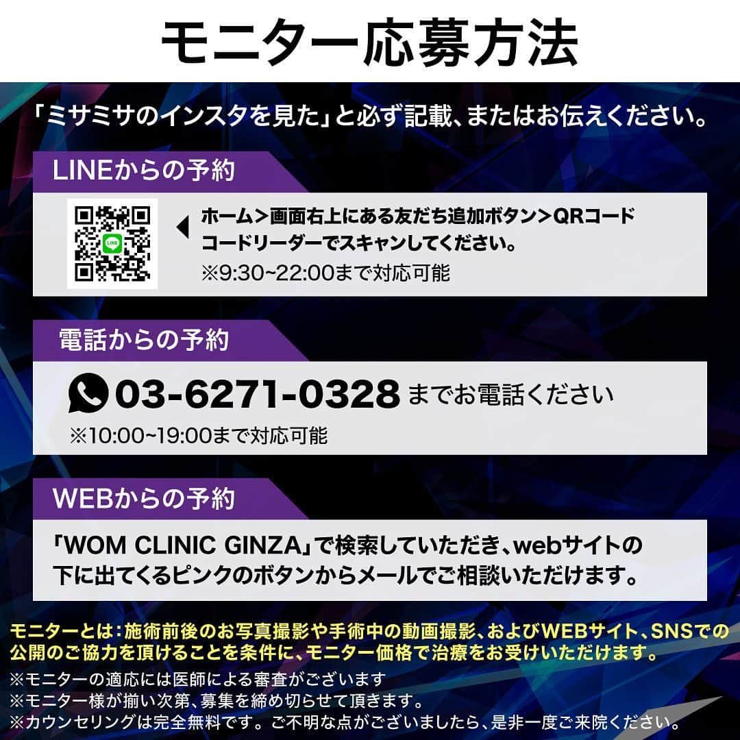 櫻井美沙季さんのインスタグラム写真 - (櫻井美沙季Instagram)「【みさみさ×WOM CLINIC】 🔥コラボ企画🔥  わたしの大切なスポンサーである @womclinicginza 様とのコラボ企画が始まりました🔥！  数々のボディビルダーやトレーニーの脂肪吸引を手がけてきた ベテランの先生にお任せすれば、ダウンタイム中でもトレーニングできます🙆‍♀️  脂肪吸引こそ、経験豊富で技術力の高い先生にお願いするべきです☝️  減量の後半になってから、「お腹周りがどうも落ちきらなくて…」  と相談にかけこむ方が多いそうなのですが、 オフシーズンのうちに脂肪吸引をし、物理的に脂肪細胞の数を減らしておくほうがオススメです🙆‍♀️  もちろん、トレーニングされていない方もぜひこの機会にご検討ください！🩵🩷  お腹・胸下の脂肪吸引をされる方には「3D脂肪吸引が無料」になります！！！  ※モニター応募方法は4枚目をご覧下さい🙆‍♀️  ※ミサミサのインスタ見た、とお伝えいただく必要があります✨️  ※ビフォーアフターの写真はわたしではなくモニター様の症例写真です✨️  #ワムクリニックギンザ #womclinicginza #脂肪吸引 #アブクラックス #腹筋割れたい #ミサミサコラボ」11月16日 14時25分 - misamisa_ifbb_figure_pro