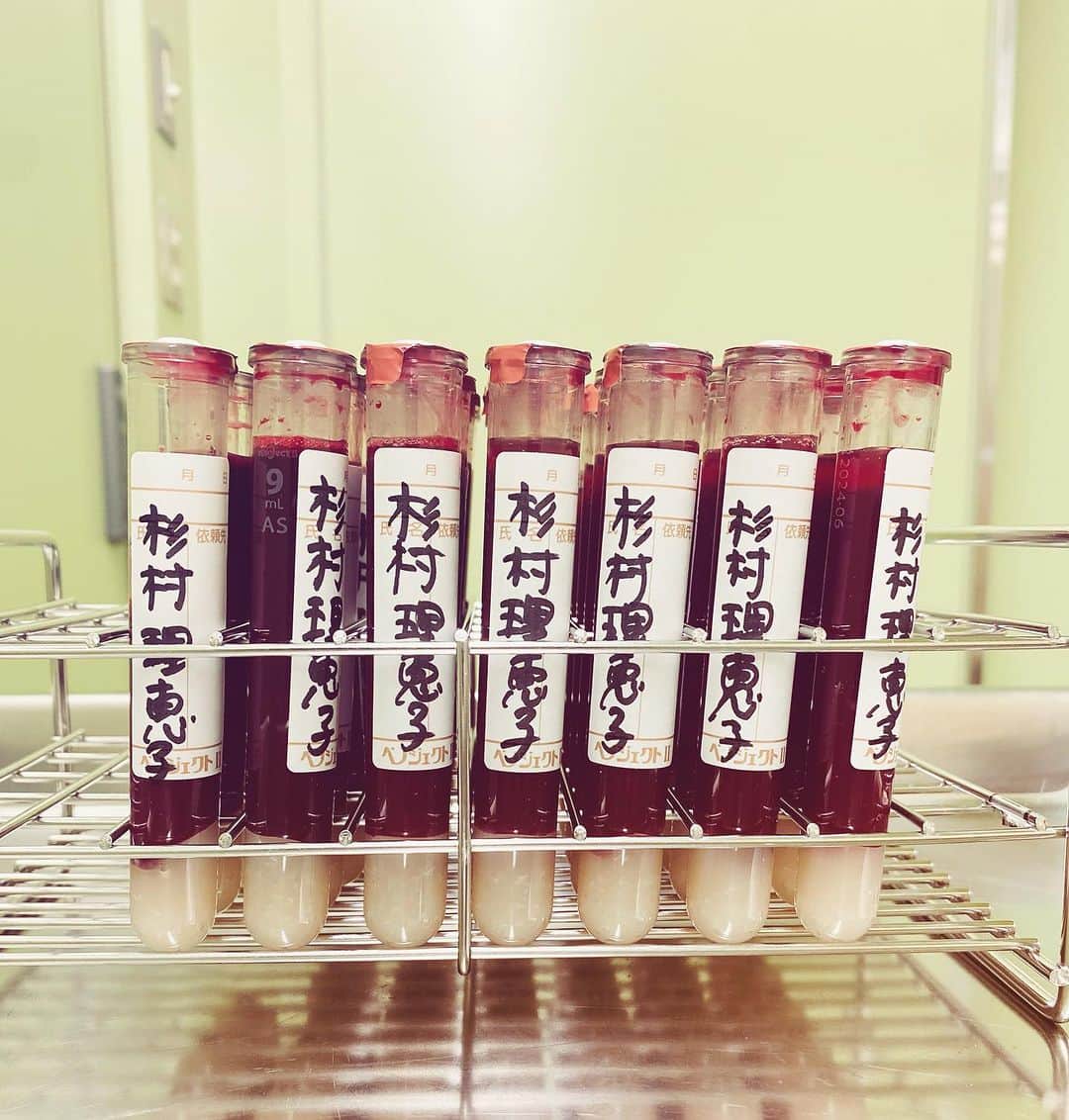 杉村理恵子のインスタグラム：「線維芽細胞培養移植 自分の線維芽細胞を自己血液を餌に何億倍へと培養してお肌に戻す治療 私的には究極の自然派アンチエイジング治療です。 だって、自分のものを増やして戻すだけですから。  本日はその餌となる採血に288ccごっそり採ってきました。 前にも同じ量を採っているので、それと合わせて1回目はお顔と首へ、2回目はもう一度お顔へと。。。 充分な量が培養できましたら、 1週間置いて2回水光注射で真皮へと移植します。  4年ぶりにするので楽しみです 30歳前からこの施術をスタートして 今回で4回目  お肌の土台をつくりお肌の厚さを保ってくれる線維芽細胞は、ハリ感を保つ上で必須 年齢と共に段々死滅してしまいますから、補うには移植しかありません。 ハリが保てる＝シワにもなりにくい、もちろんタルミも 線維芽細胞はコラーゲンエラスチンを排出してくれる細胞ですからね。  ここ慶友クリニックは、線維芽細胞移植のパイオニア。 私がこの治療をスタートした頃(20年前)その頃は、線維芽細胞培養し移植しているのは、慶友クリニックともう1箇所くらいでした。(その1箇所は培養は委託していたと記憶してますので、実質ここのクリニックですね) その頃から、こちら慶友形成クリニックでは線維芽細胞採取→培養→注入と、すべて院内で行ってたんです 先駆者でしょー！  地味な治療ですが、5年後10年後のお肌は違います 49歳の私、首にシワがないのは、線維芽細胞のおかげ💕  長々と読んで下さってありがとうございます ご興味のある方はぜひご連絡ください、ご紹介致します。」