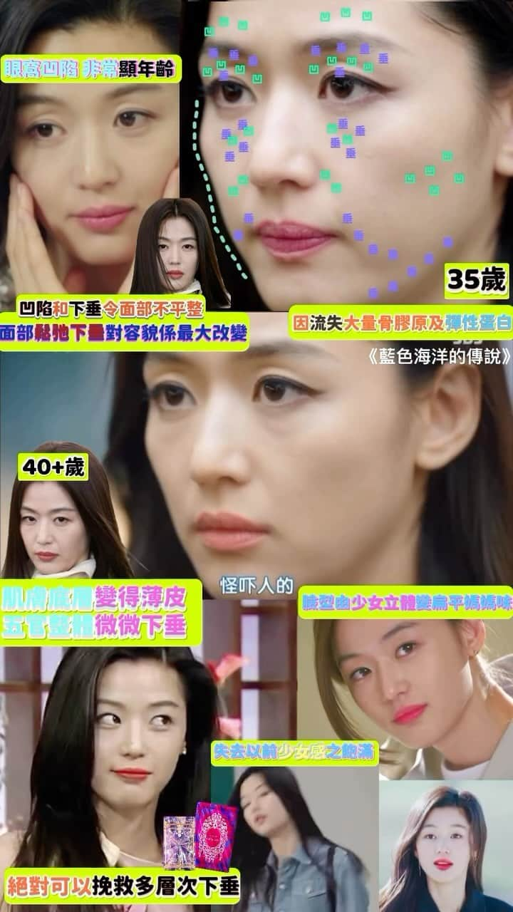 Beautyrankingのインスタグラム：「35歲  眼窩凹陷 非常顯年齡 臉型由少女立體變扁平媽媽味  凹陷和下垂令面部不平整 面部鬆弛下垂對容貌係最大改變  鬆弛可以令到走晒樣  失去以前少女感之飽滿 因流失大量骨膠原及彈性蛋白 肌膚底層變得薄皮、五官整體微微下垂 特別眼窩凹陷 、眼見給人感覺疲累老態  #collagen #collagendrink #膠原蛋白 #膠原飲 #整形級 #修復肌膚 #整形 #美白 #微整形 #醫美 #醫美術後 #變靚 #童顏」