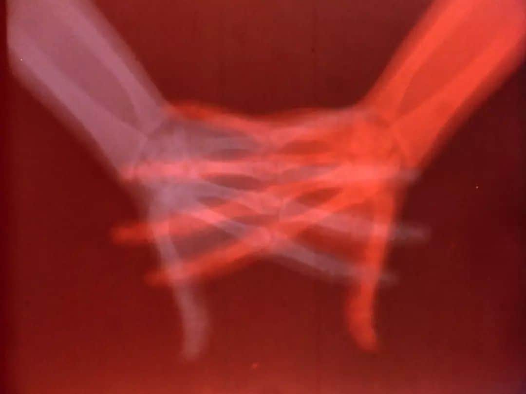 テート・ギャラリーのインスタグラム：「Where the medical gaze can dehumanise its subjects, Barbara Hammer’s film ‘Sanctus’ re-humanises hers. One of the pioneering queer filmmaker’s most significant works, 'Sanctus' reminds us of the body’s fragile beauty.   Using archival 1950s X rays, Hammer superimposes images and text calling attention to the effects of radiation. Intimately acquainted with the body as both a sensual and diseased subject, the artist elevates the physical form with stunning colours and Neil B. Rolnick’s operatic score.   See Hammer’s ‘Sanctus’ alongside the films of Leslie Thornton, Caroline Key, and Jeamin Cha as part of Tate Modern’s November Film Series #ScienceBodyAnatomy. Find the full programme below ➡️  🎞️ 24 November, 7pm – 8.30pm: Explore the intersection between film and medical technology through a series of artists’ films including Barbara Hammer’s film ‘Sanctus’. This will take place as part of Tate Modern Lates. Book your free tickets today.  🗣️ 25 November, 4.30pm – 5.15pm: Join us at Tate Modern’s Starr Cinema for a free talk from @movingimagenyc’s Curator of Science and Technology, Sonia Epstein, as she discusses the historical and contemporary ways filmmakers have engaged with the body through medical imaging.  🎥 25 November, 6pm – 8pm: For day two, discover the films of Ana Mendieta and Jyoti Mistry, both works uniquely placed within bodies. In a rarely screened, untitled short film completed in the 1970s, Mendieta displays her body through the use of X rays, raising awareness of the policing of women's bodies, across time and space. Forty-five years later, Mistry's ‘Cause of Death’ revisits the theme, highlighting feminicide and the recurrence of violence against women. Book your tickets via the link in our bio. 🔗  🖐💀 Barbara Hammer, Sanctus 1990, film stills. Courtesy of the Estate of @BarbaraHammer1 and Electronic Arts Intermix (EAI), New York  🎥 Jyoti Mistry, Cause of Death 2020, video still. Courtesy of Jyoti Mistry and sixpackfilm, Vienna  🚶 Unidentified Orthopaedic Subject 1935, video still. Courtesy of the @WellcomeCollection」