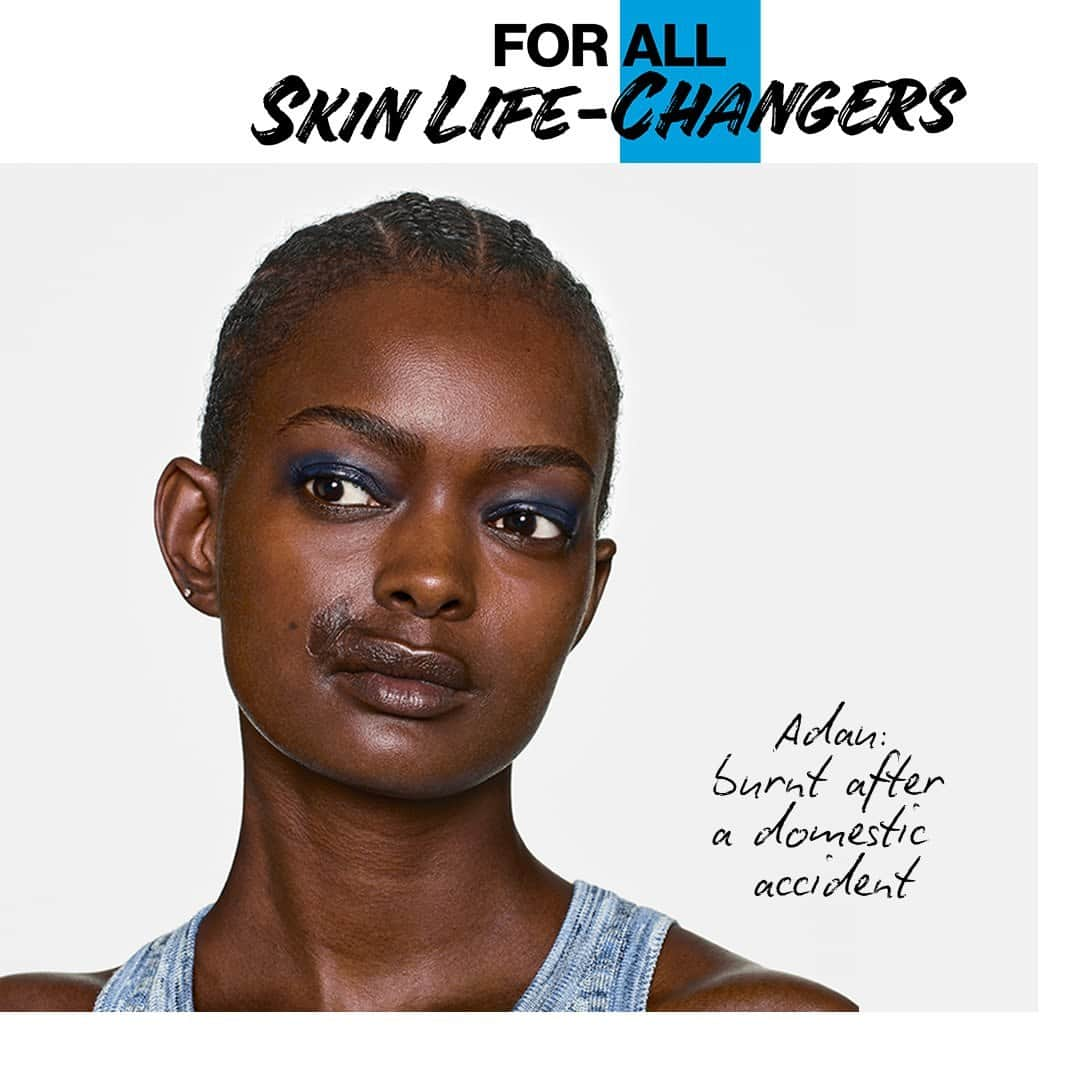 La Roche-Posayのインスタグラム：「Meet our #skinlifechangers. From patients, to dermatologists, to products and scientists, everyone is taking a stand for skin health. They lead the way and inspire others to care for their skin by sharing their journey, feelings, and doubts while spreading a powerful message of hope.  All languages spoken here! Feel free to talk to us at anytime. #larocheposay #dermatology #scars #oncology #acneproneskin Global official page from La Roche-Posay, France.」