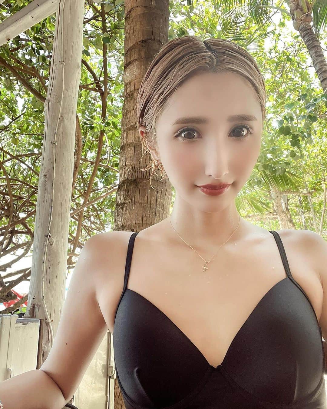 長瀬葵のインスタグラム：「3回目のプルージュクリニック行ってきました😌 * * 今回はほうれい線と目の下のくまにぷるぷる注射をしました。 * ぷるぷる注射は異物を入れるのではなく、自身の皮膚が再生されるため、ヒアルロン酸やボトックスより、効果が長期にわたって持続します。 加齢による肌の衰えと同じスピードで、効果が徐々に薄れてきますが、周りの肌と同じように自然に変化していくという意味でとても安心です。(HPより引用✍️) * * ほうれい線がほんとに気になってたからわかんなくなったって言ってもらえて満足🙏🏻 * * クリニックは @pruge_clinic  * 担当の先生は @pruge_okamoto  です😌 またよろしくお願いします😌 * * #ぷるぷる注射  #プルージュ美容クリニック」