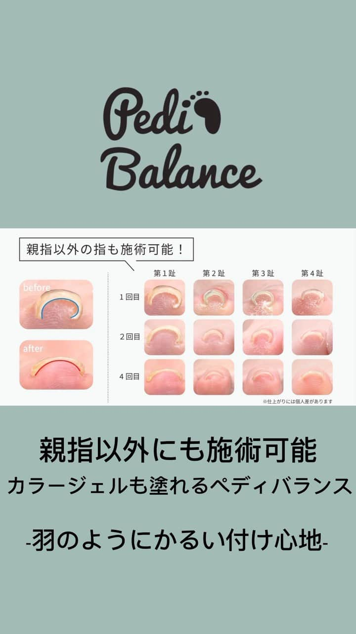 NAIL PARTNER　ネイルパートナーのインスタグラム：「2023.11.19 発売 NAIL EXPO 2023 にて初お披露目👏🏻🎊  〚Pedi Balance〛(ペディバランス) 羽のようにかるい付け心地の巻き爪ケアジェル  一般的なジェルネイルと同様の使い方で巻き爪ケアを行うことができます✨  ー６つの特徴ー 1.巻き爪ケアをしながらカラージェルが楽しめる (ｶﾗｰｼﾞｪﾙ全29色） 2.足の親指以外の指にも施術が可能 3.韓国で特許を取得済みのジェルで割れにくい 4.施術時の痛み、収縮や締め付けの少ない快適な付け心地 5.指にフィットして握りやすいブラシキャップ 6.ジェルネイルの延長としてサロンワークに導入しやすい  韓国で開発された巻き爪専用のジェル(ブースター・ベースジェル・カラージェル・トップジェル)を塗布し、巻き爪ケアを行います。 たくさんの器具や材料をそろえる必要がなく、ジェルも低価格なため、コストを抑えてサロン導入ができます。  この度、NAIL EXPO 2023で初お披露目となります👏🏻🎉 ネイルパートナースペシャルステージ、リッカジェル&ペディバランスブースにて、出井由美先生・山内美代子先生による解説&デモンストレーションを行いますのでぜひ足をお運びください！  お試しコーナーにはカラージェルも全てご用意しております💅  ペディバランスでケアを行ったモデルさんの、リアルなBefore・After施術写真が載っているリーフレットもお配りしておりますので、ぜひお手に取ってご覧ください👀  #ペディバランス#巻き爪#巻き爪ケア#フットケア#フットネイル#ペディキュア#NAILEXPO#EXPO#エキスポ#ネイルエキスポ」